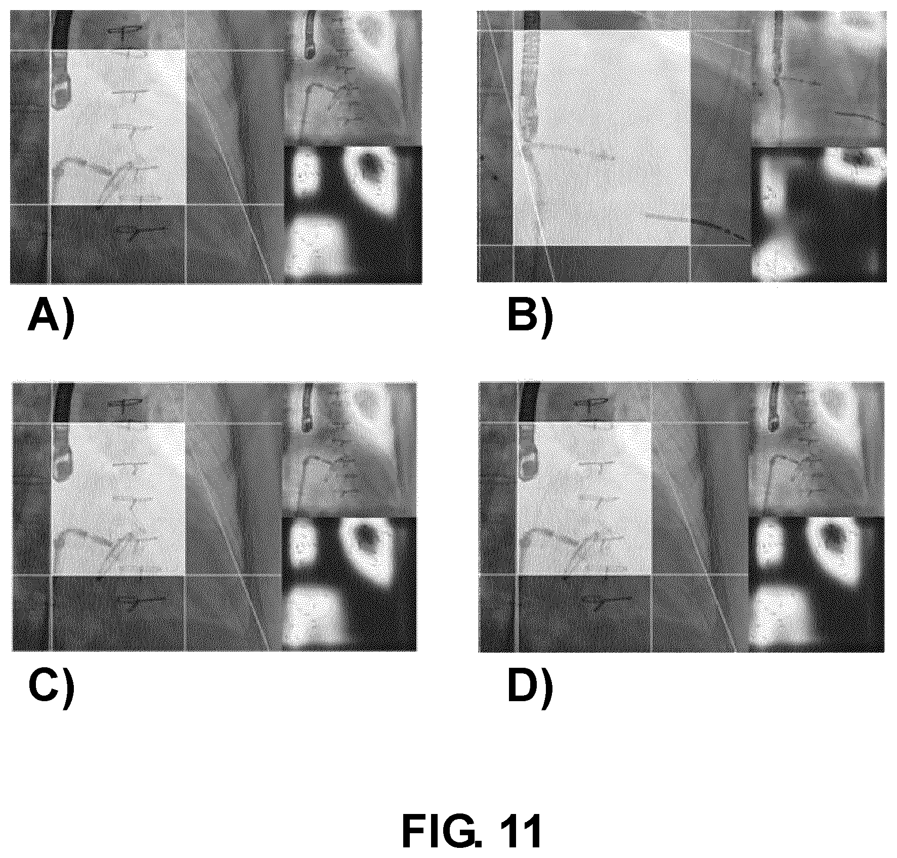 Patent US12350089 Figure 11 – Adaptive collimation for interventional x-ray