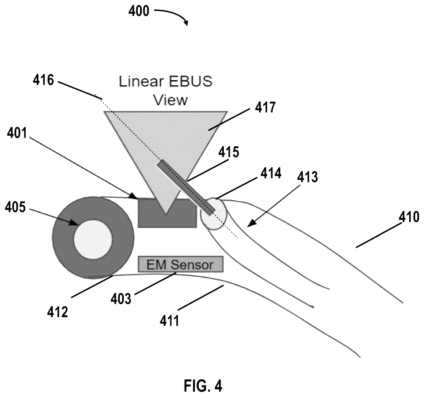 Patent US12350092 Figure 4 – Systems for a triple imaging hybrid probe