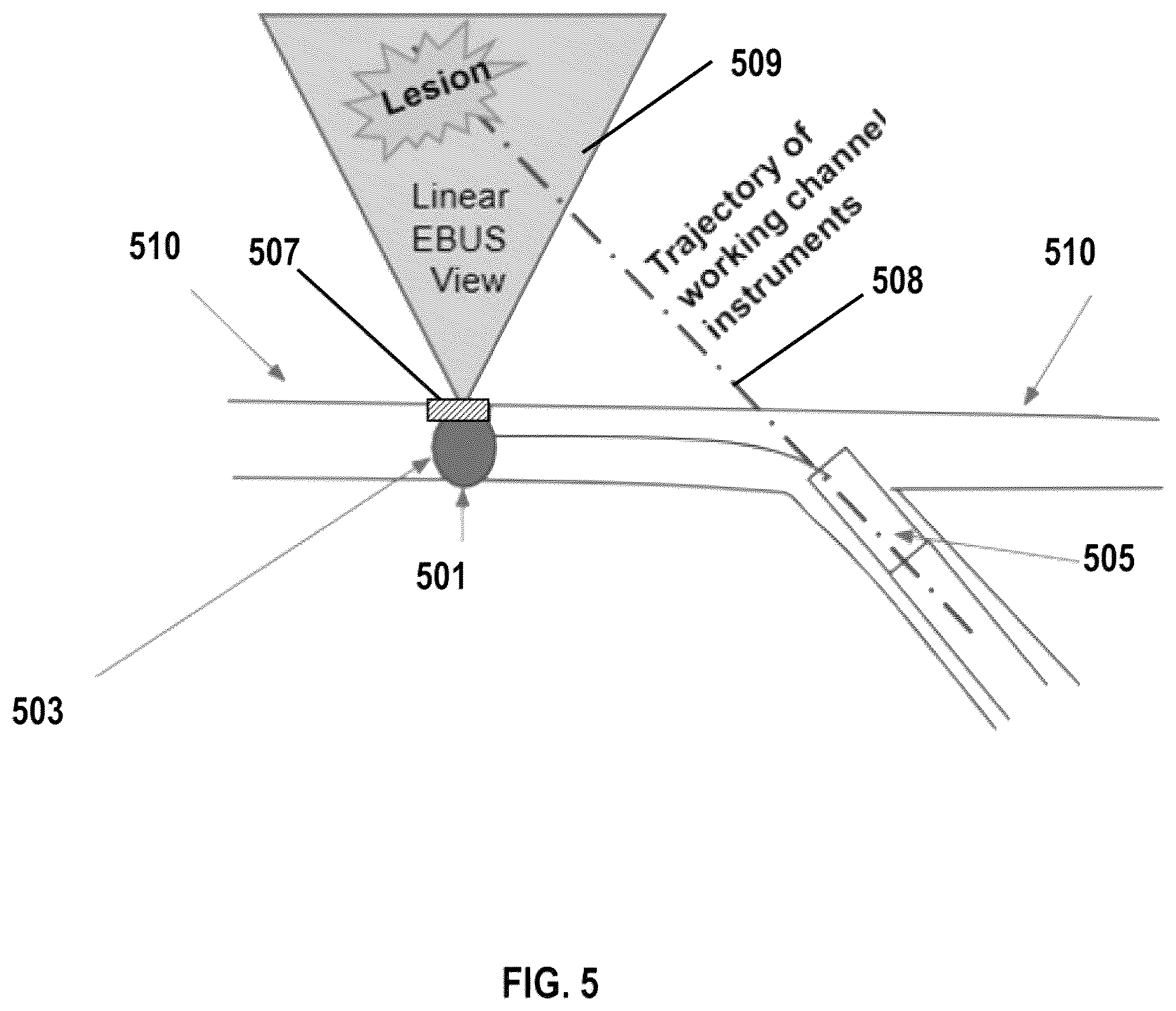 Patent US12350092 Figure 5 – Systems for a triple imaging hybrid probe
