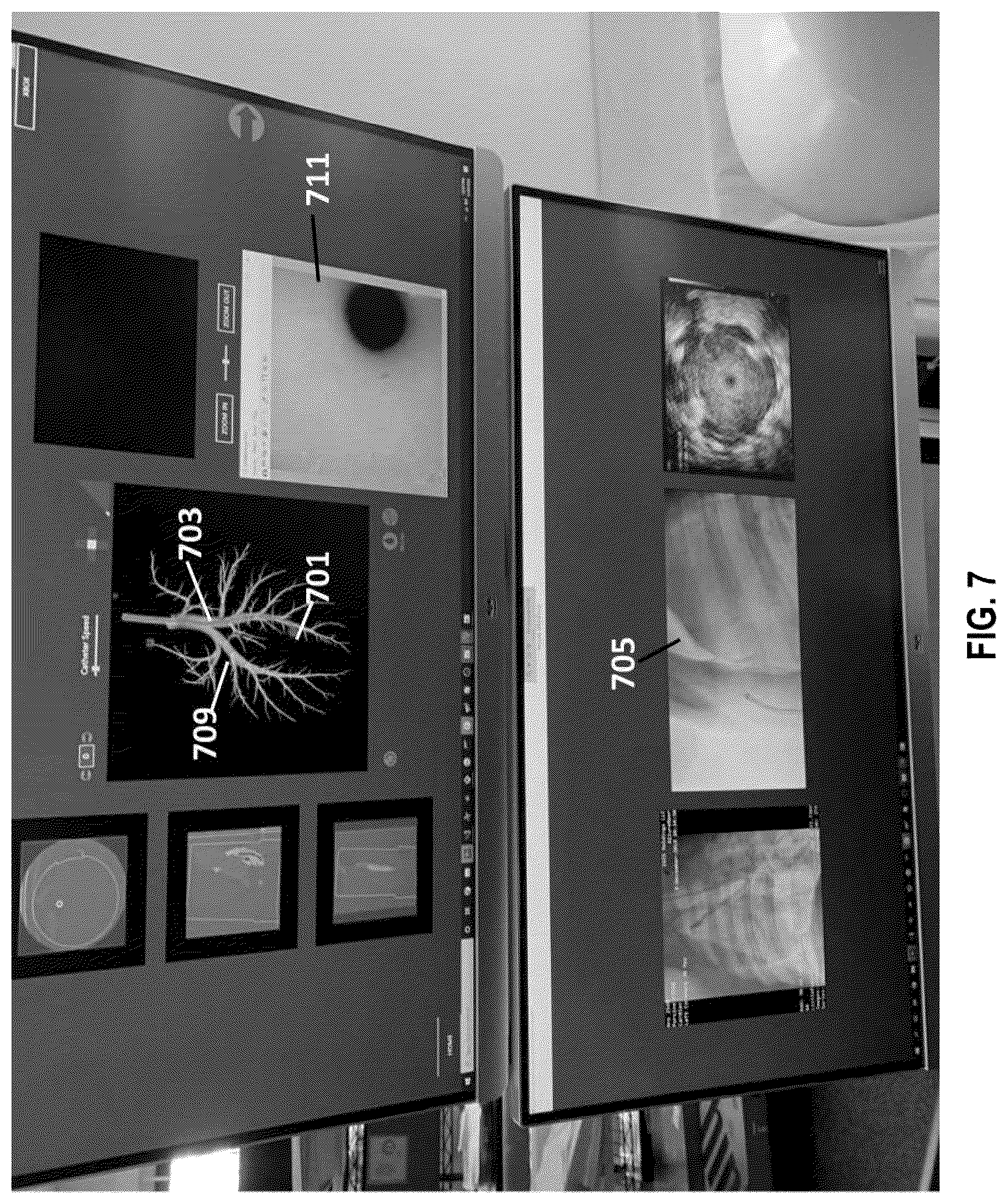Patent US12350092 Figure 7 – Systems for a triple imaging hybrid probe