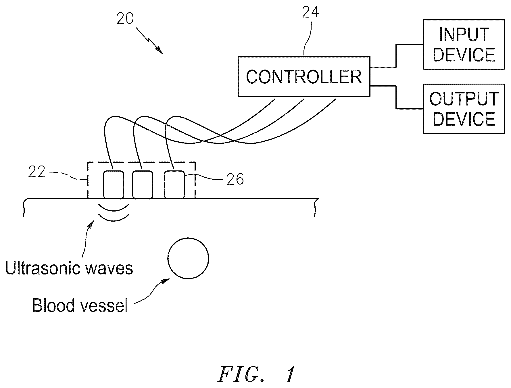 Patent US12350093 — Apparatus and method for tracking blood vessel cross-section — Figure 1