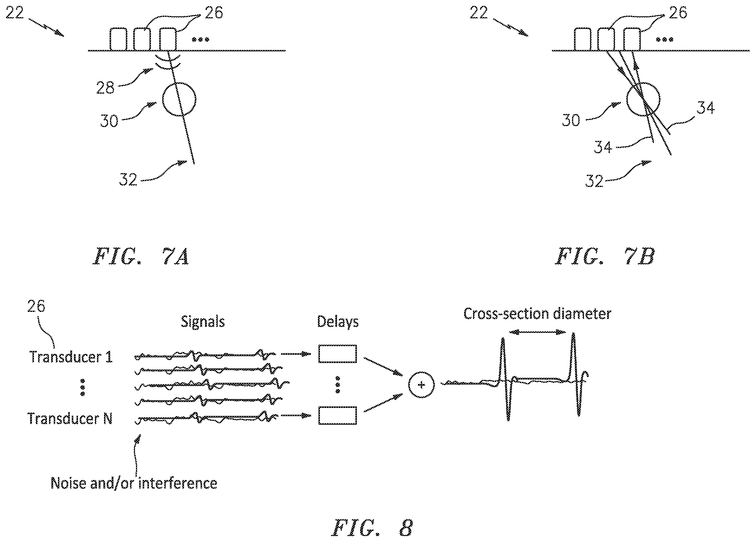 Patent US12350093 Figure 6 – Apparatus and method for tracking blood vessel cross-section