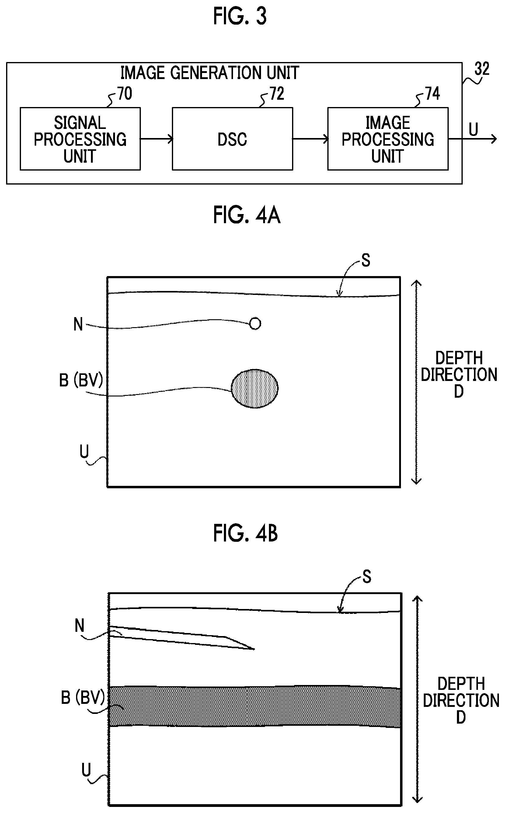 Patent US12350094 Figure 2 – Information processing apparatus, ultrasound diagnostic apparatus, information processing method, and information processing program