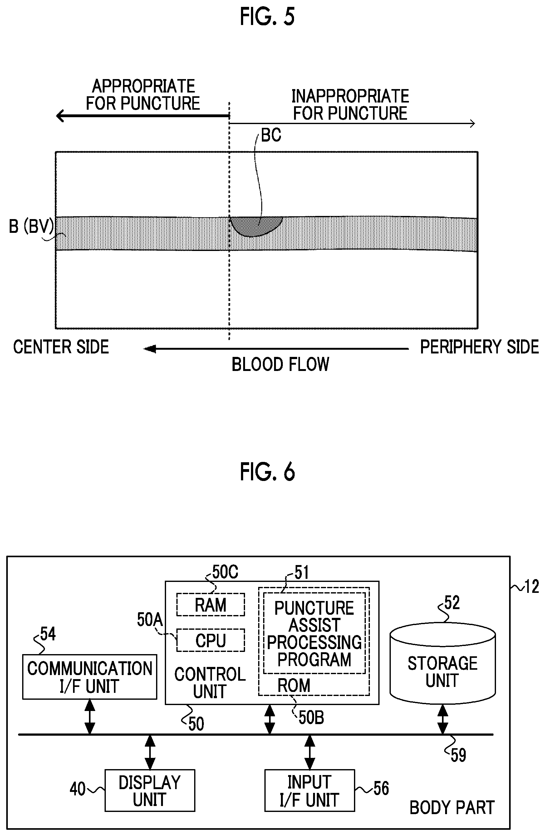 Patent US12350094 Figure 3 – Information processing apparatus, ultrasound diagnostic apparatus, information processing method, and information processing program