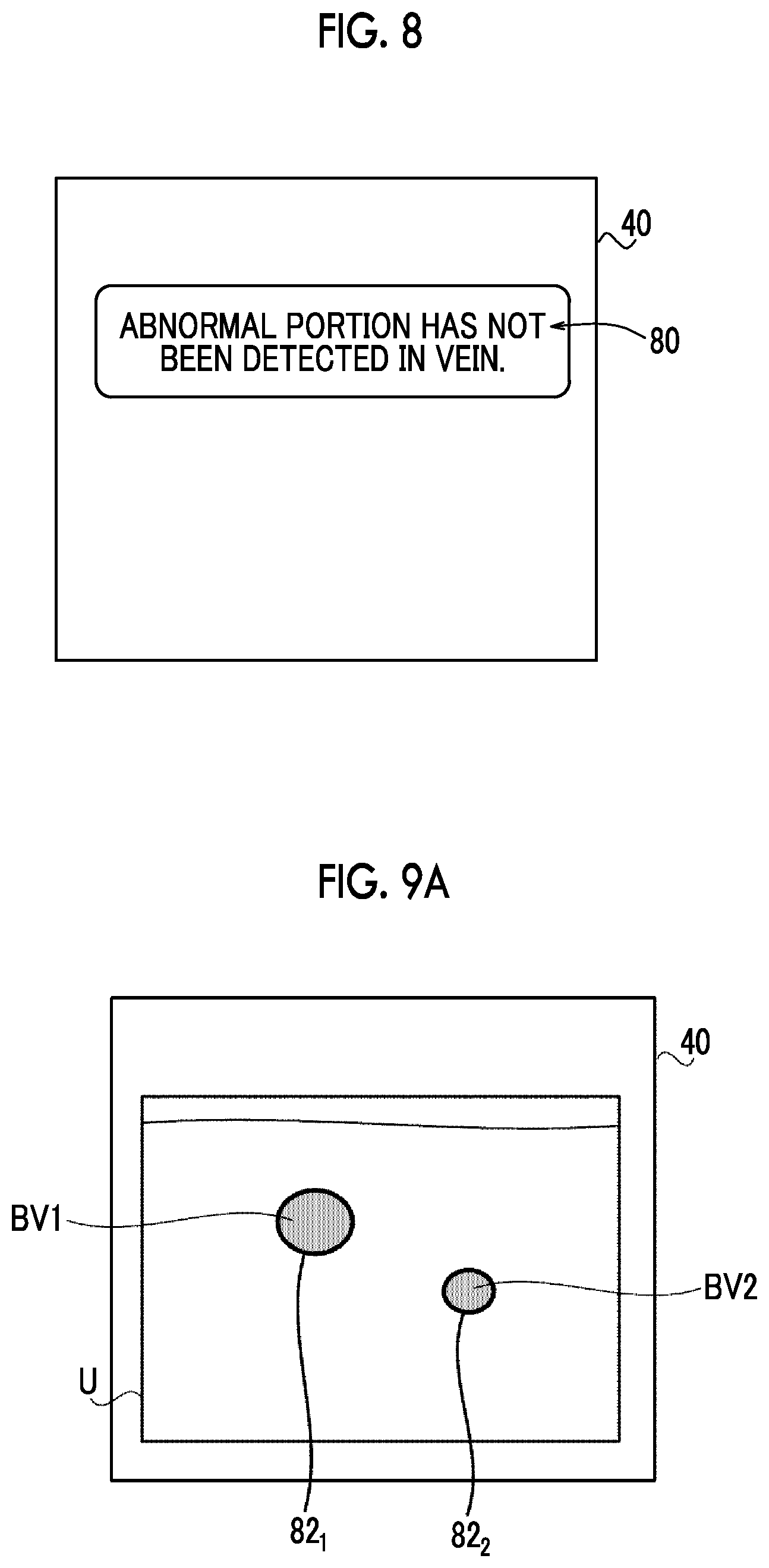 Patent US12350094 Figure 5 – Information processing apparatus, ultrasound diagnostic apparatus, information processing method, and information processing program