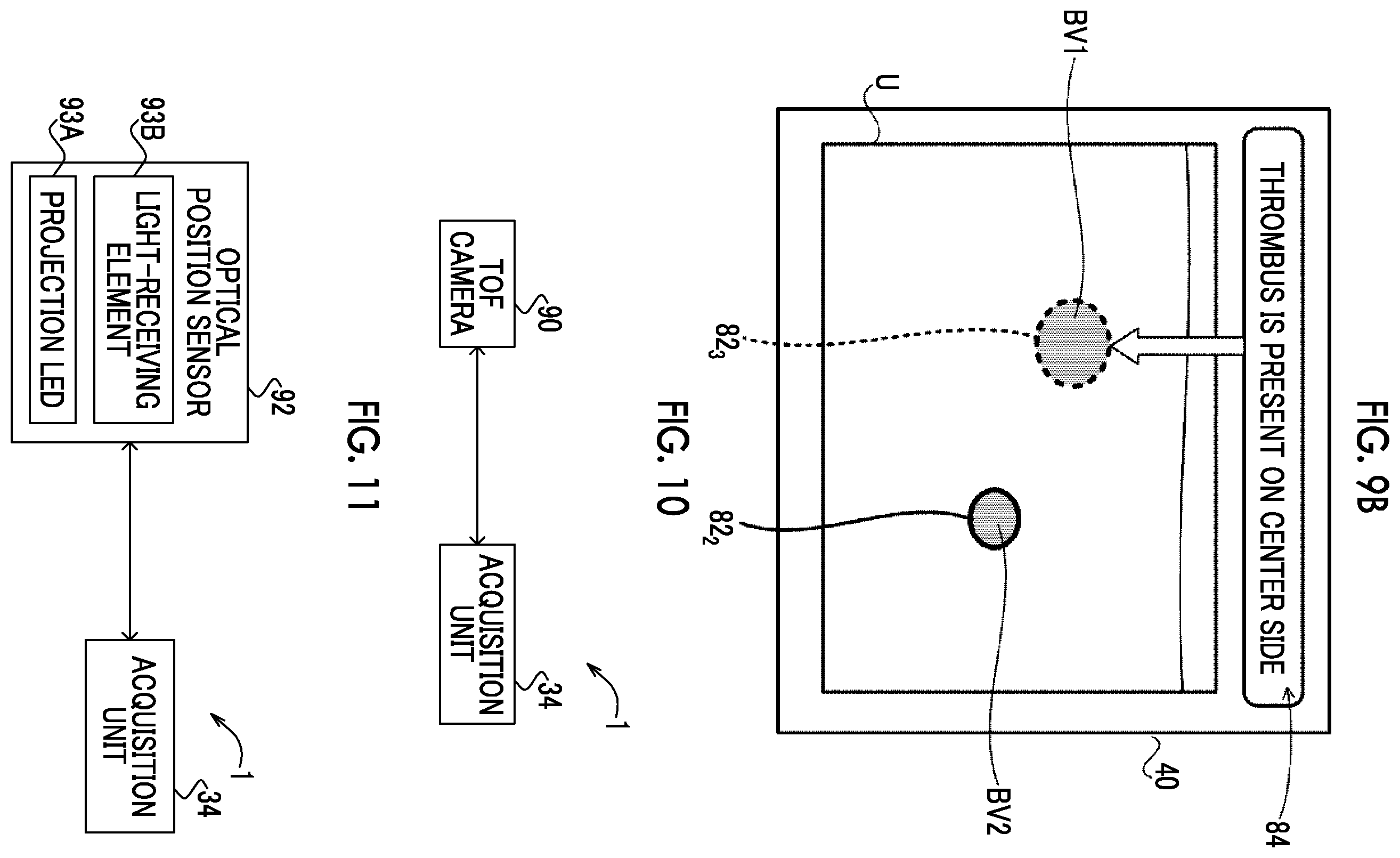 Patent US12350094 Figure 6 – Information processing apparatus, ultrasound diagnostic apparatus, information processing method, and information processing program