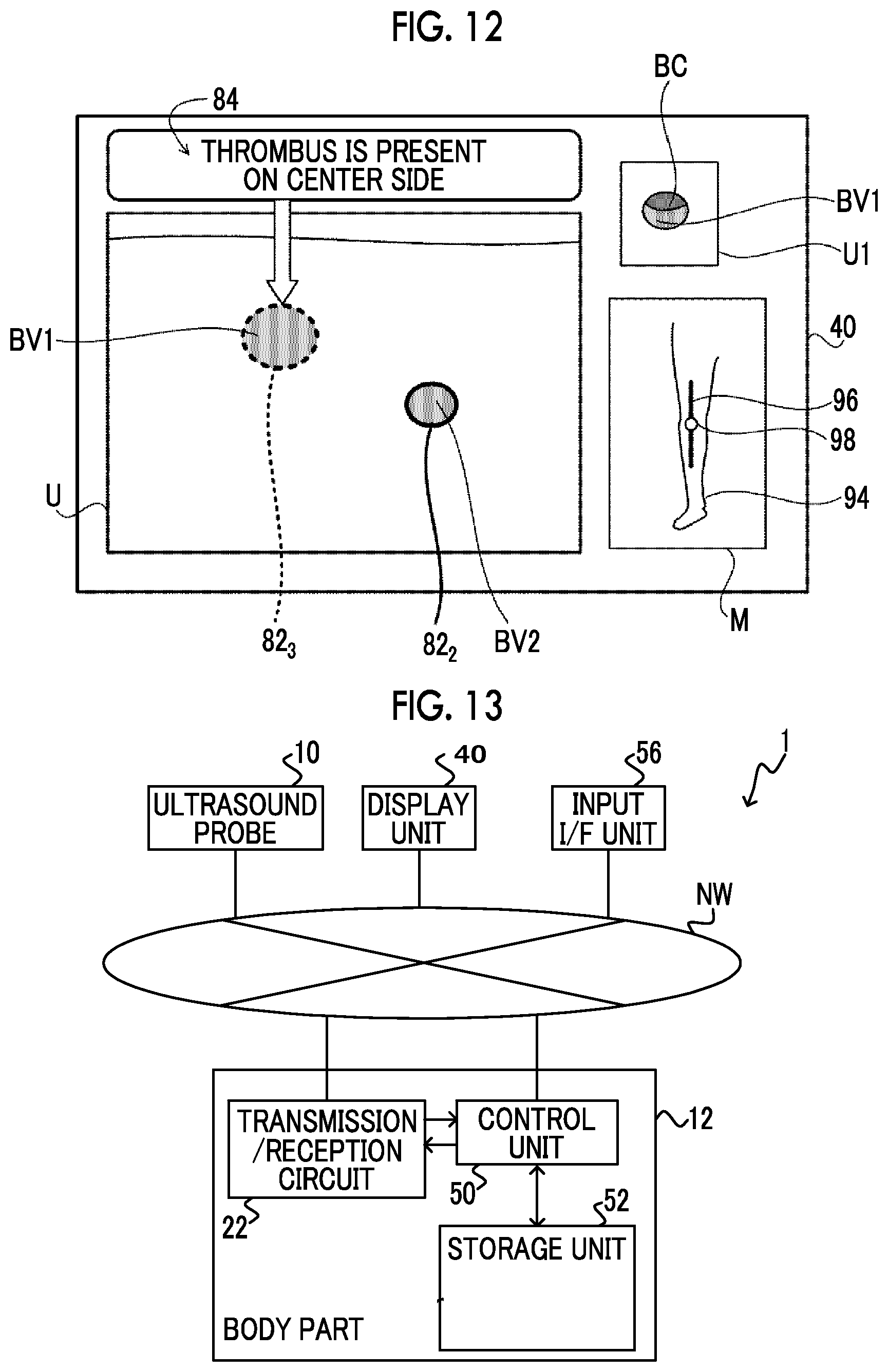 Patent US12350094 Figure 7 – Information processing apparatus, ultrasound diagnostic apparatus, information processing method, and information processing program