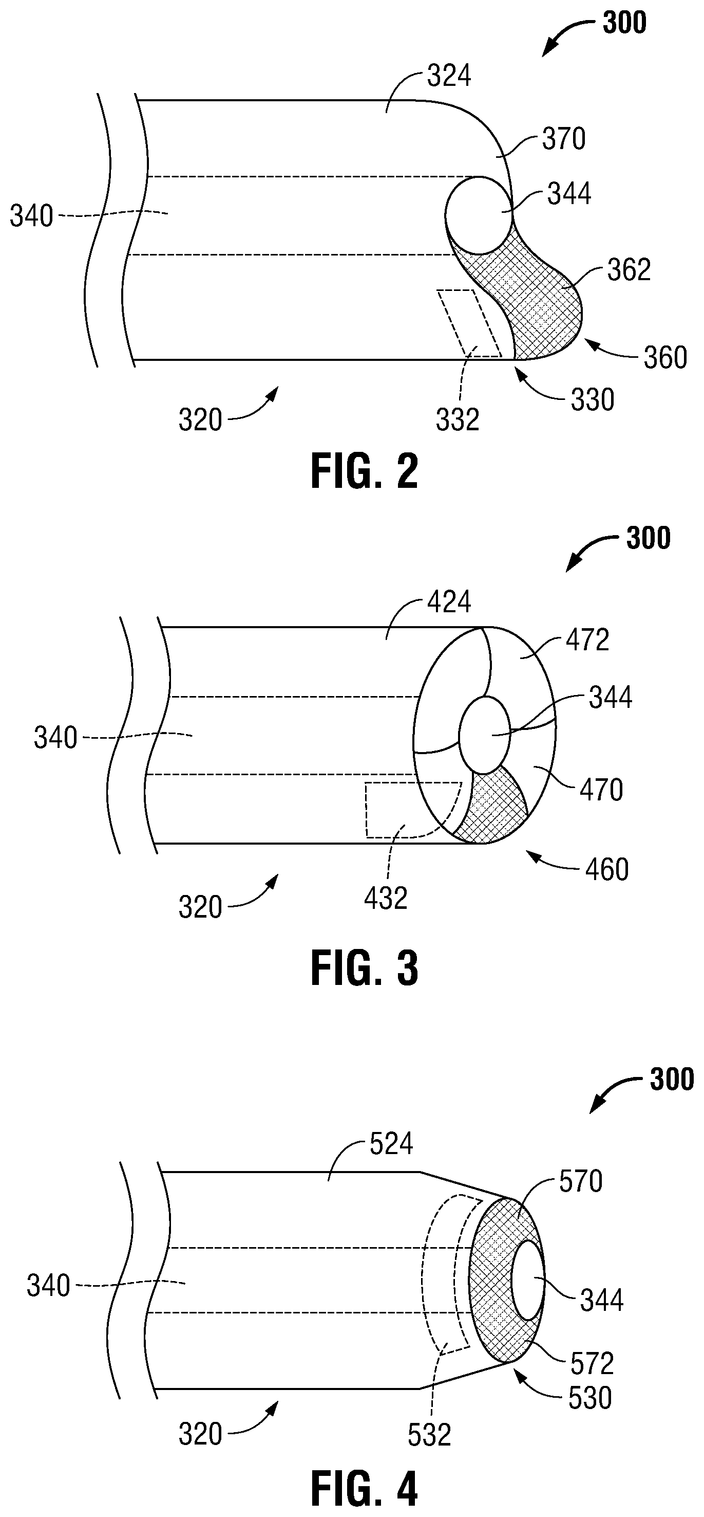 Patent US12350097 Figure 2 – Devices, systems, and methods for trans-vaginal, ultrasound-guided hysteroscopic surgical procedures