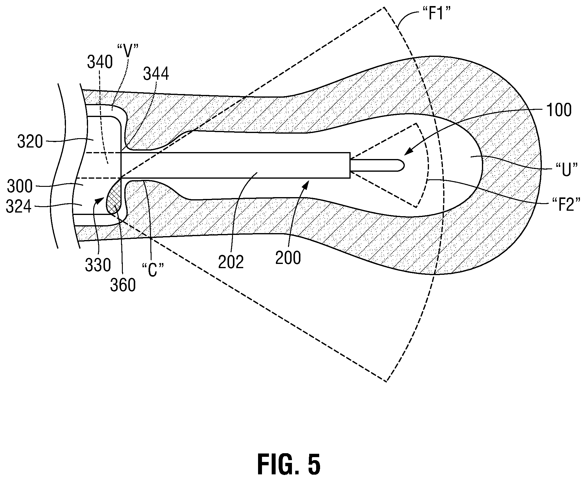 Patent US12350097 Figure 3 – Devices, systems, and methods for trans-vaginal, ultrasound-guided hysteroscopic surgical procedures