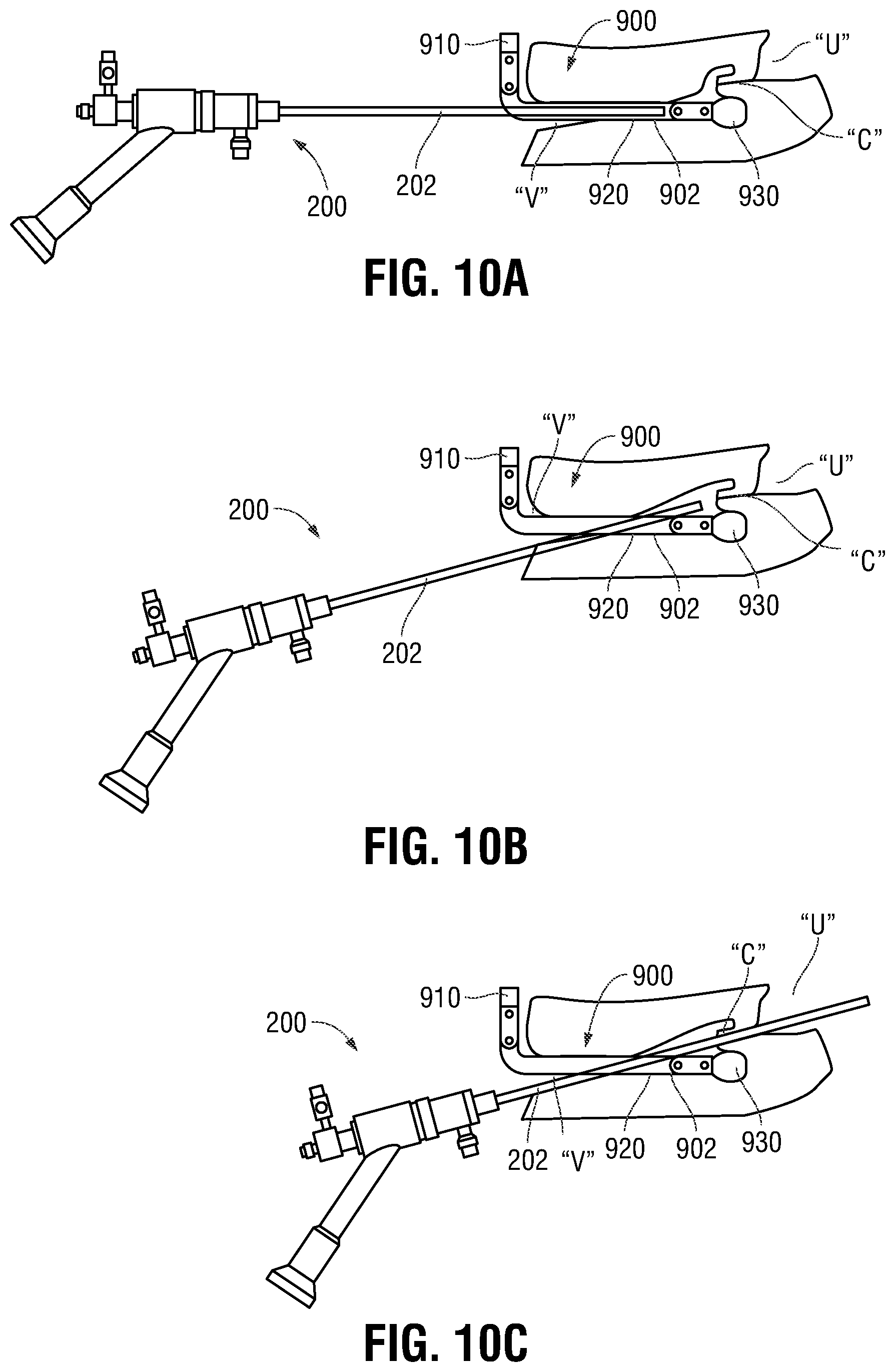 Patent US12350097 Figure 8 – Devices, systems, and methods for trans-vaginal, ultrasound-guided hysteroscopic surgical procedures