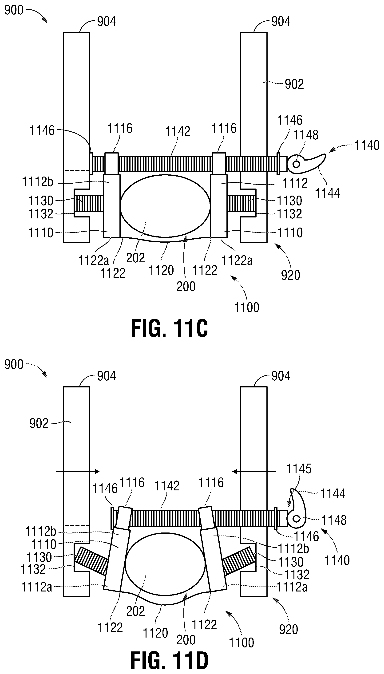 Patent US12350097 Figure 10 – Devices, systems, and methods for trans-vaginal, ultrasound-guided hysteroscopic surgical procedures