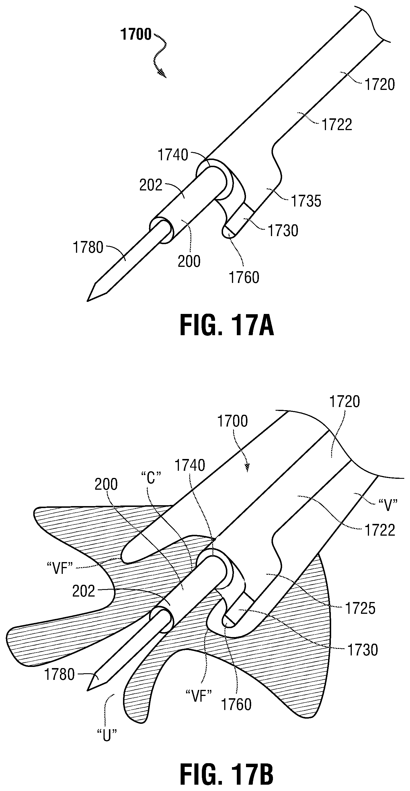 Patent US12350097 Figure 16 – Devices, systems, and methods for trans-vaginal, ultrasound-guided hysteroscopic surgical procedures