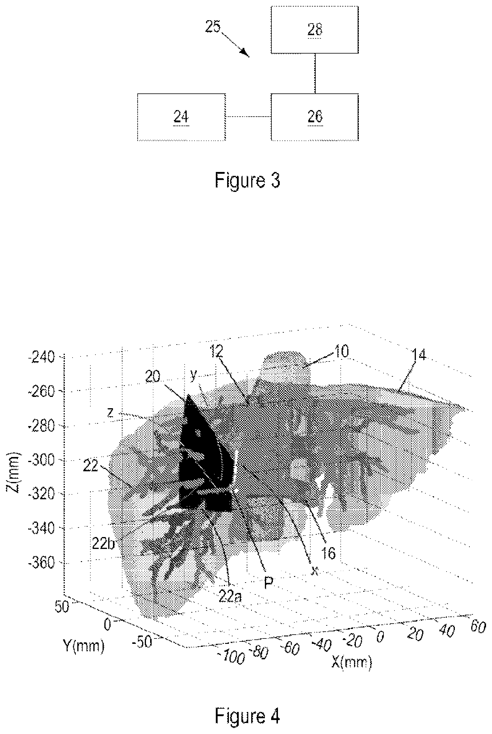Patent US12350098 Figure 2 – Ultrasound registration