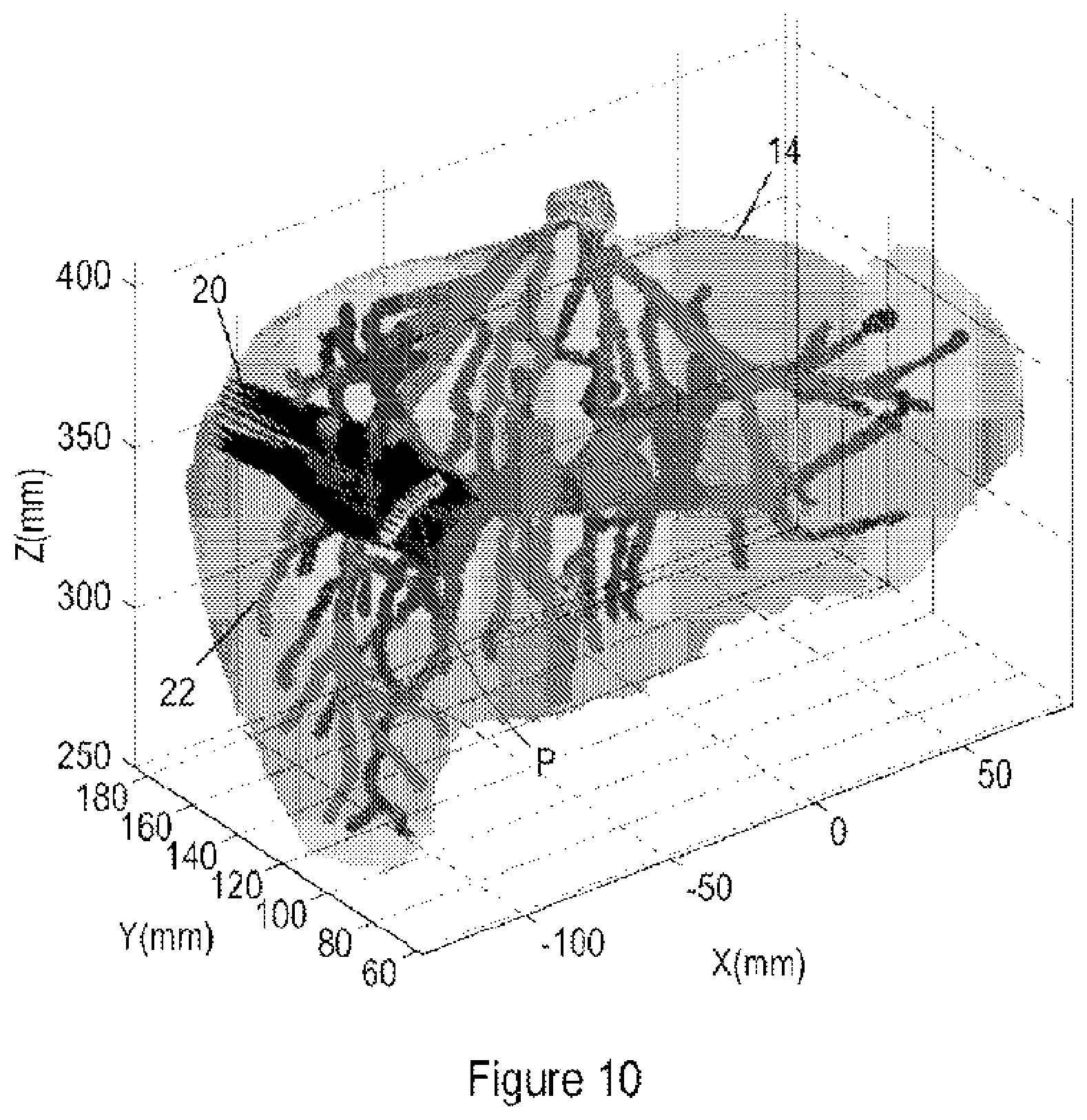 Patent US12350098 Figure 6 – Ultrasound registration