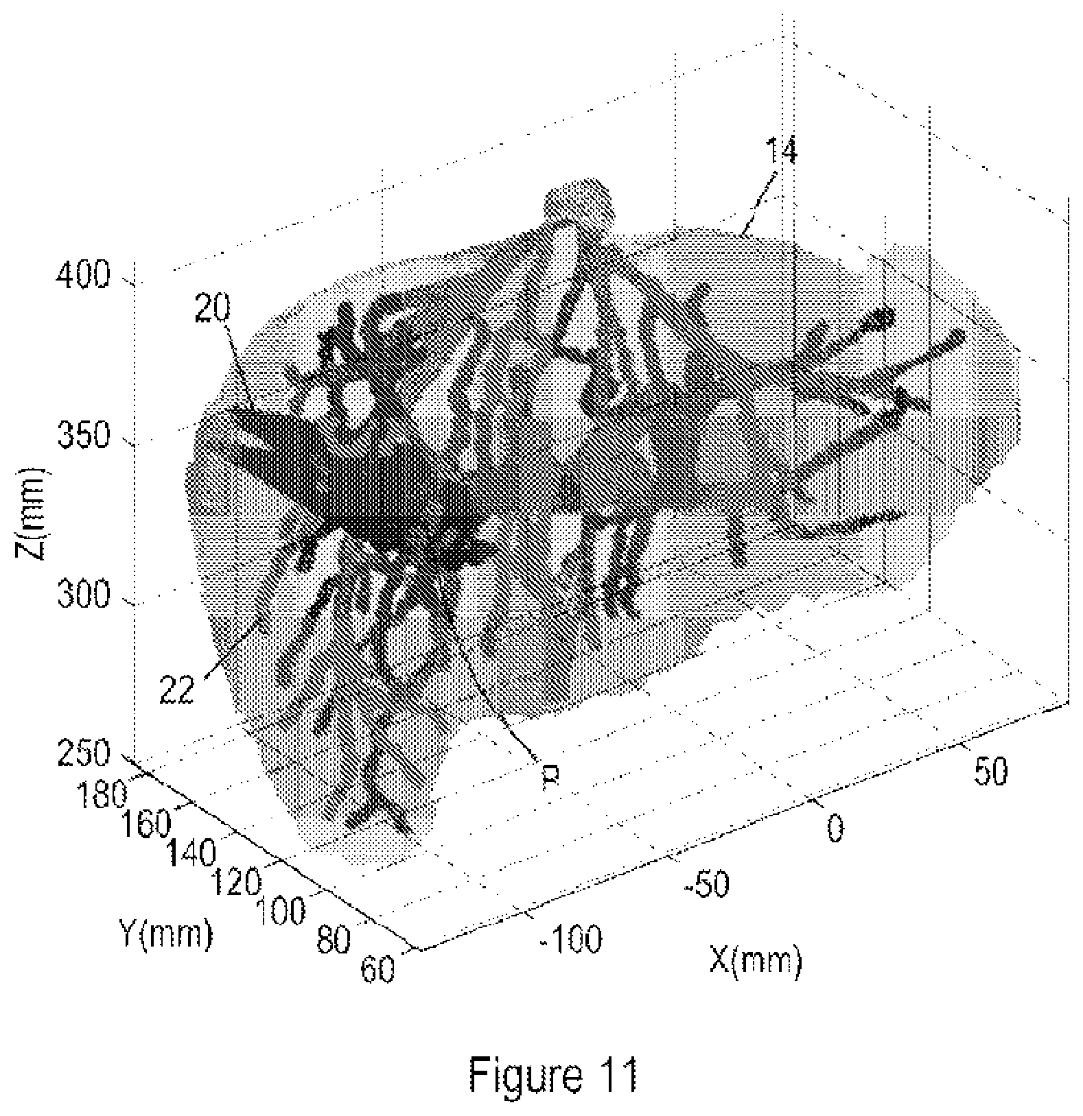 Patent US12350098 Figure 7 – Ultrasound registration