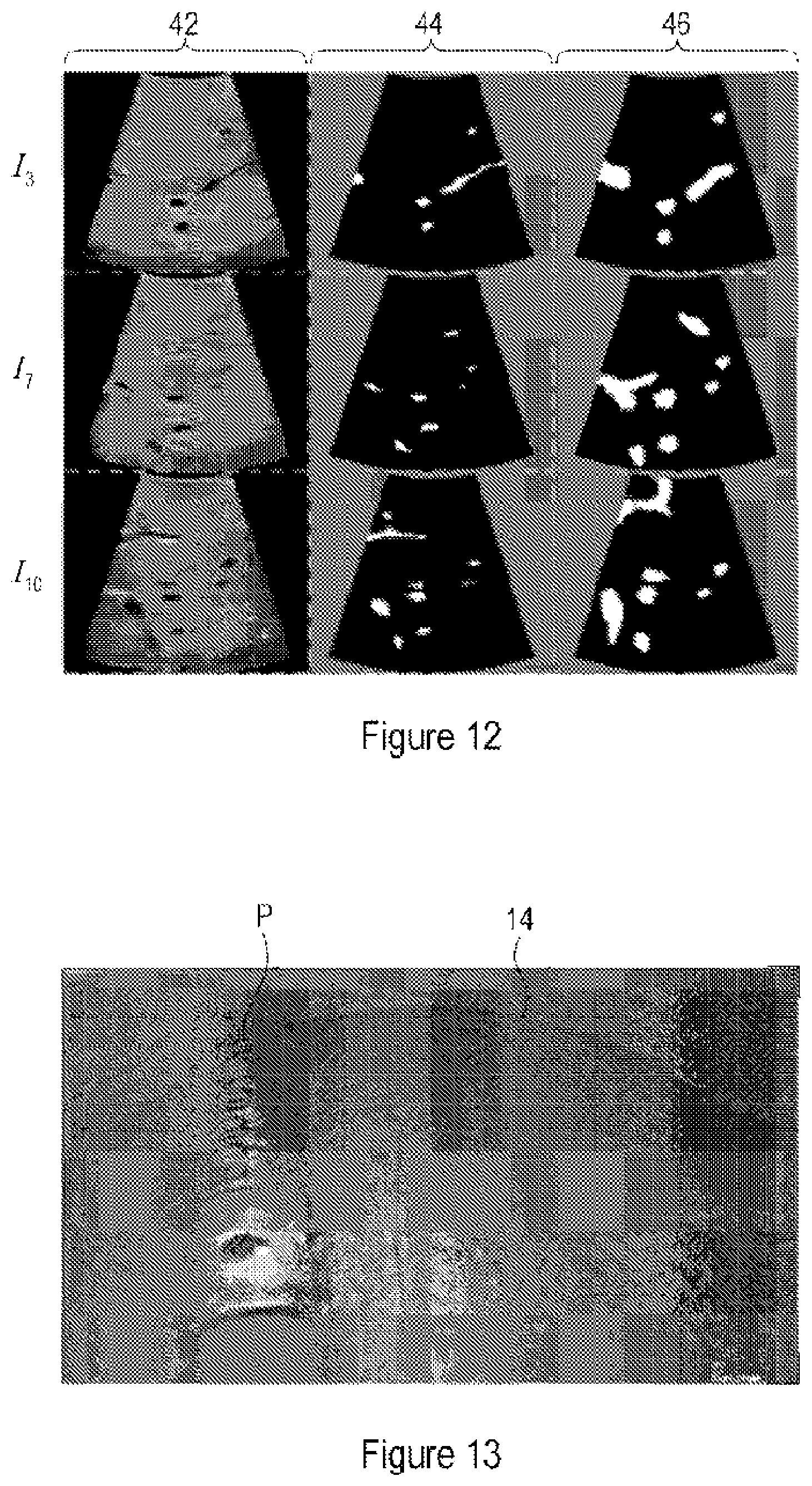 Patent US12350098 Figure 8 – Ultrasound registration