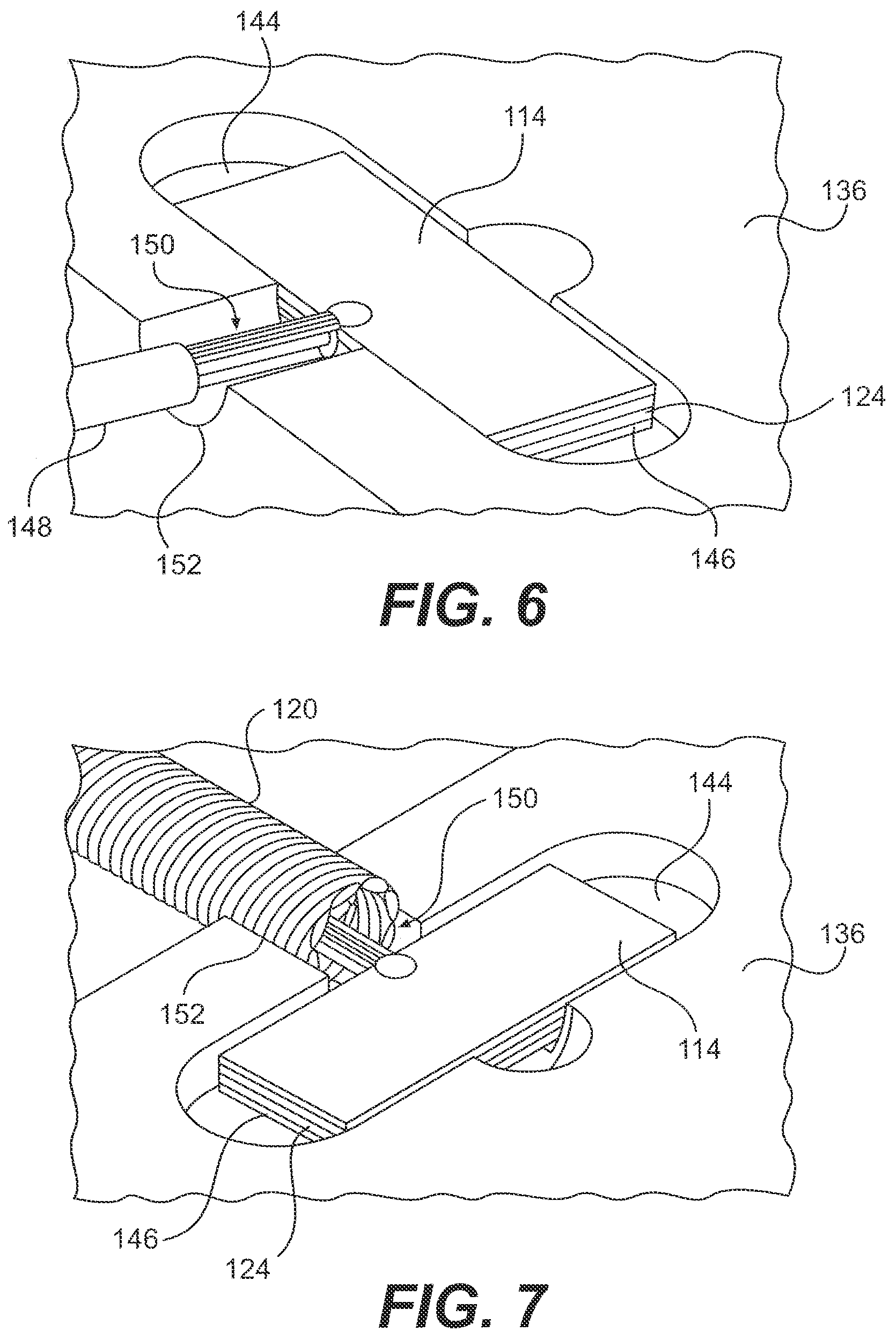 Patent US12350099 Figure 6 – Rotational intravascular ultrasound probe and method of manufacturing the same