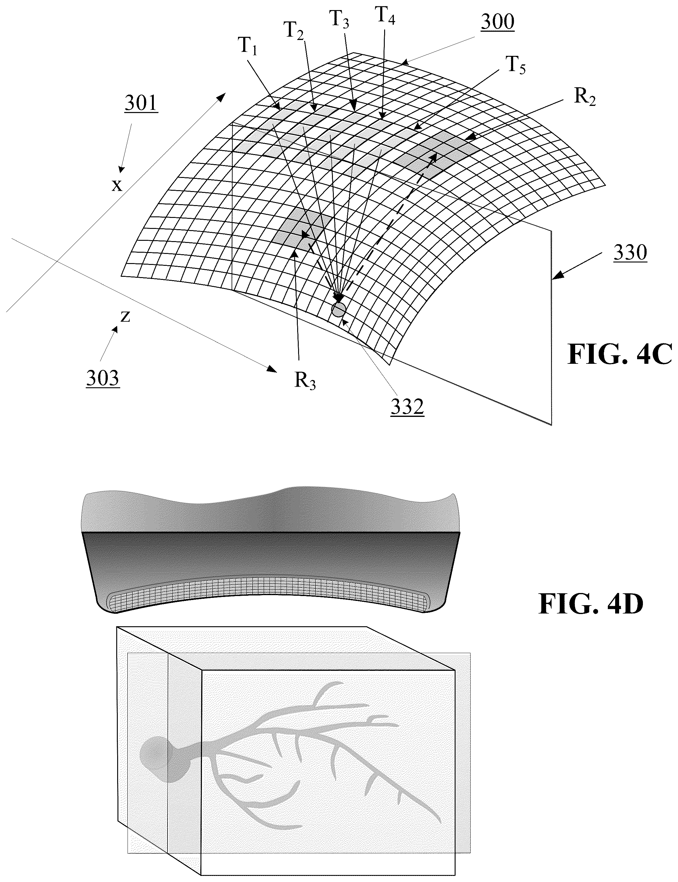 Patent US12350101 Figure 8 – Concave ultrasound transducers and 3D arrays