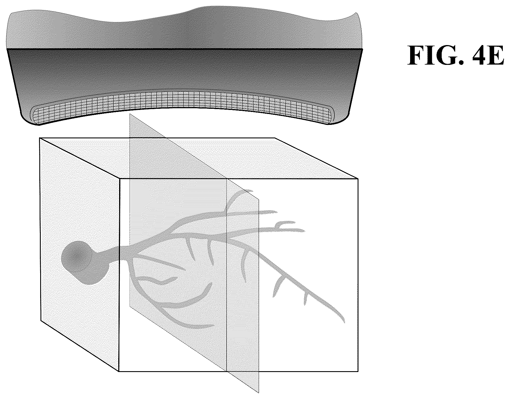 Patent US12350101 Figure 9 – Concave ultrasound transducers and 3D arrays