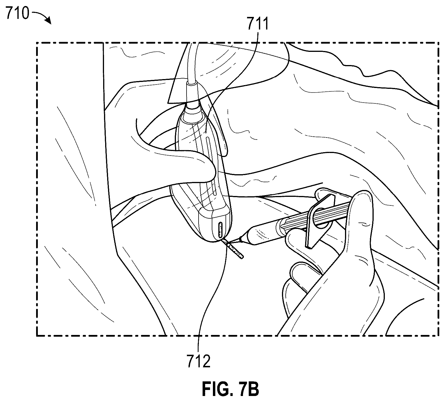 Patent US12350102 Figure 14 – Ultrasound scanner with display interface