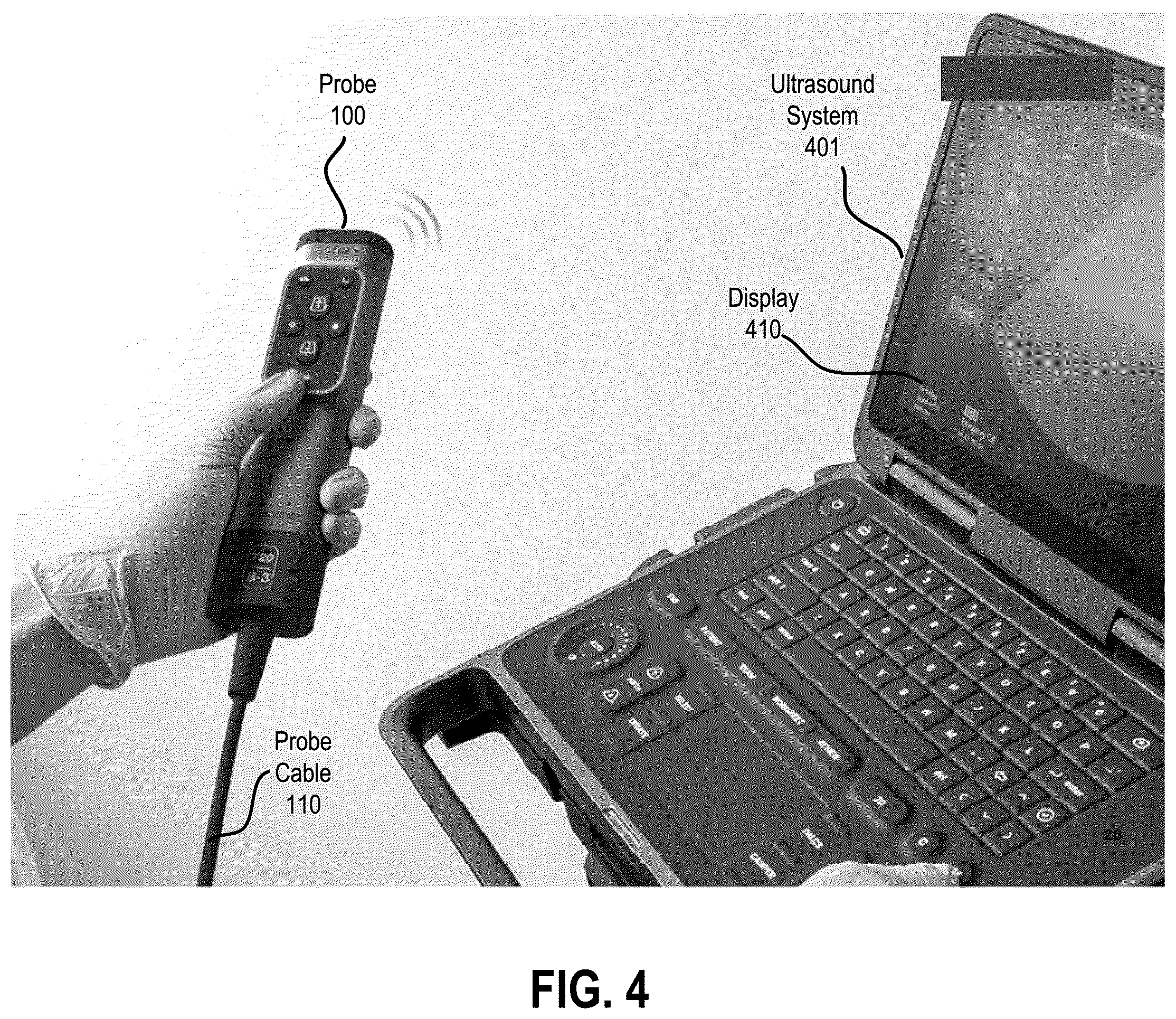 Patent US12350103 Figure 8 – Transesophageal ultrasound system