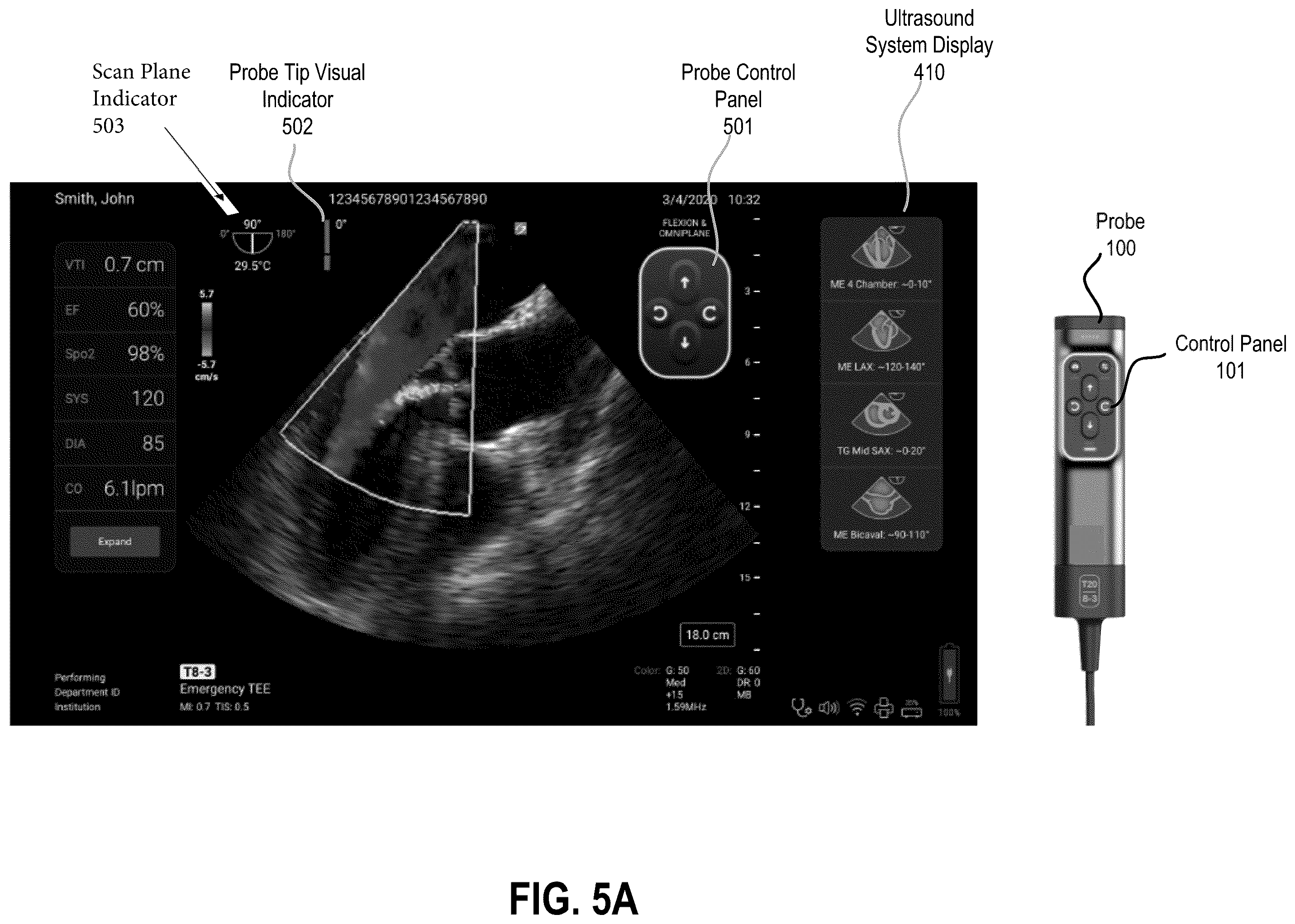 Patent US12350103 Figure 9 – Transesophageal ultrasound system