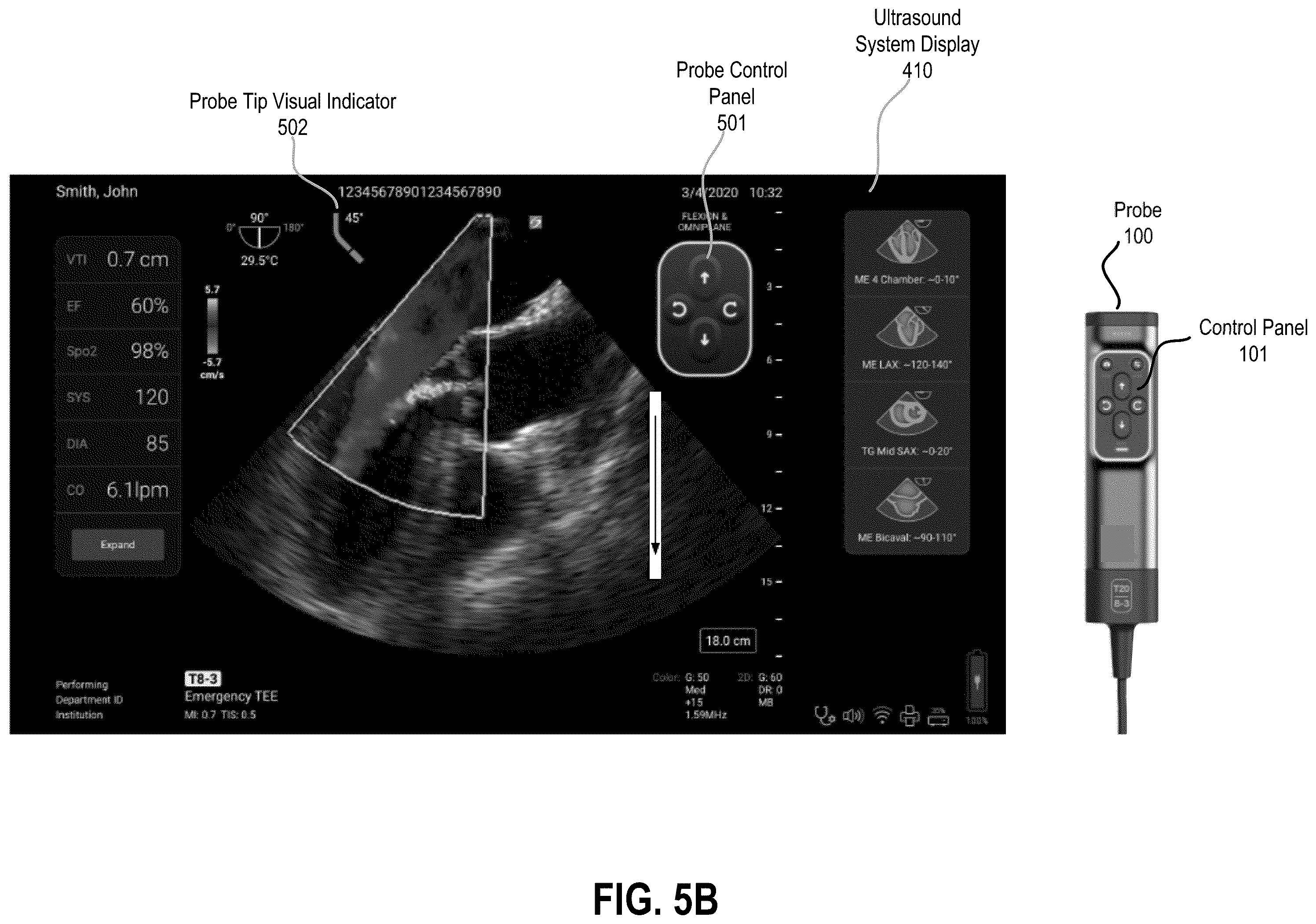 Patent US12350103 Figure 10 – Transesophageal ultrasound system