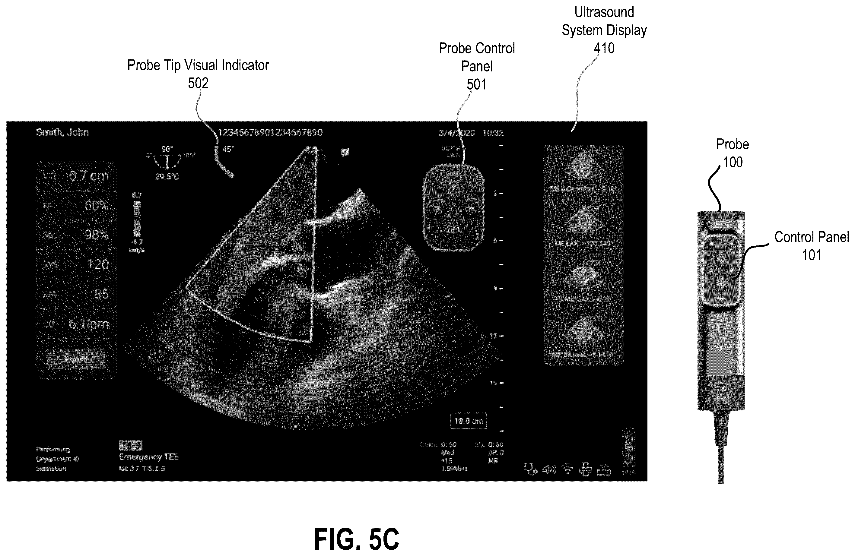 Patent US12350103 Figure 11 – Transesophageal ultrasound system