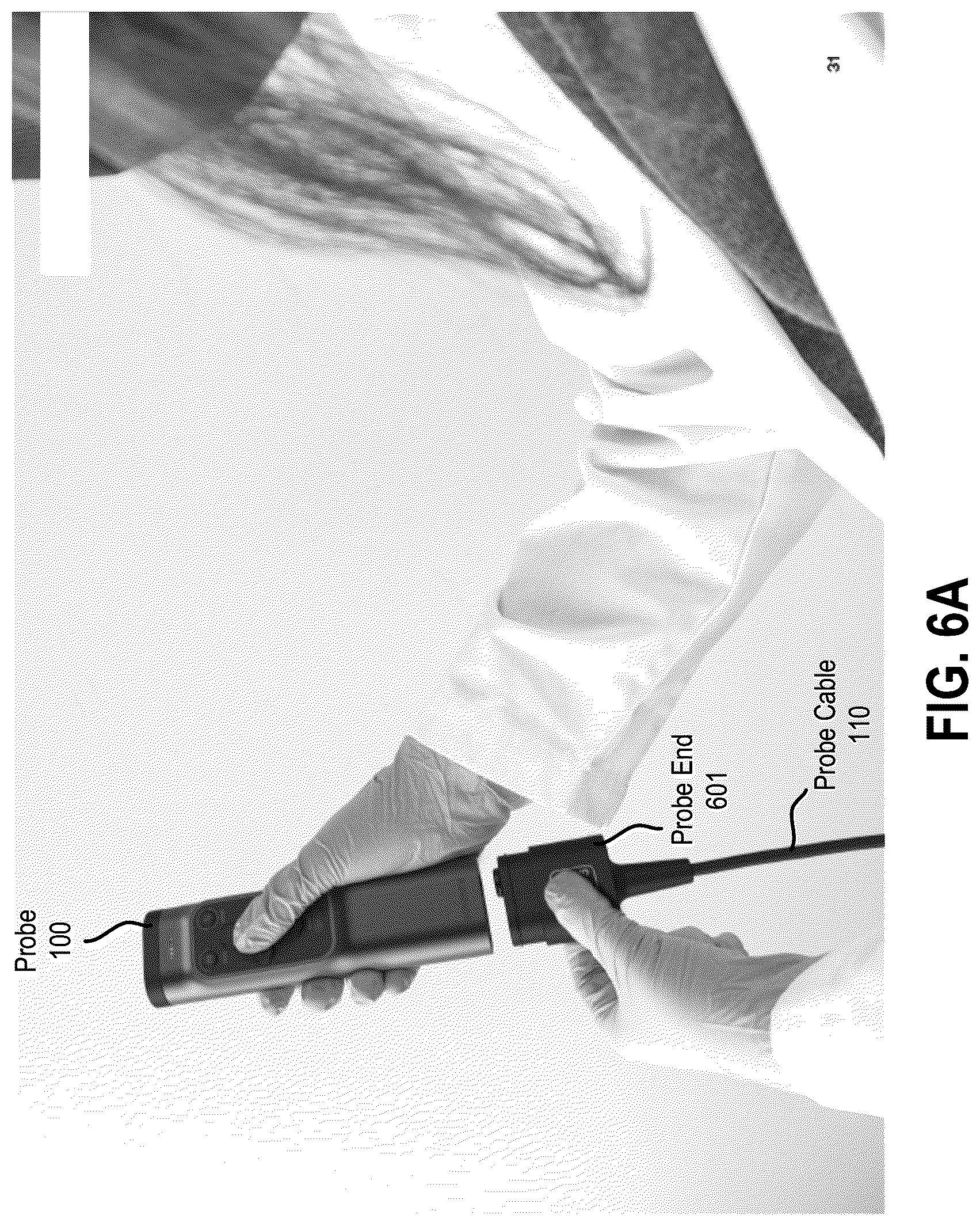 Patent US12350103 Figure 12 – Transesophageal ultrasound system