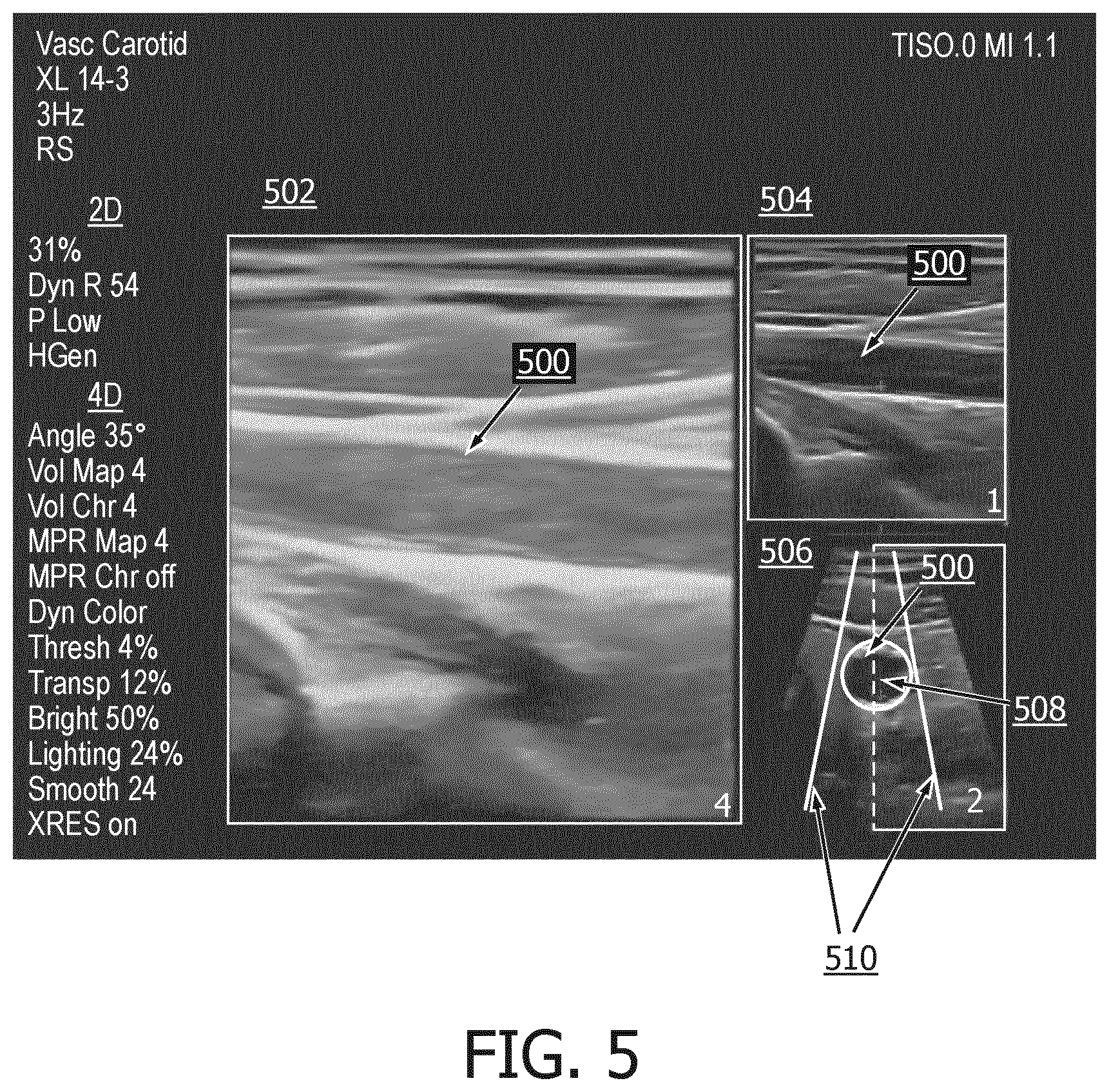 Patent US12350104 Figure 5 – Systems and methods for controlling volume rate