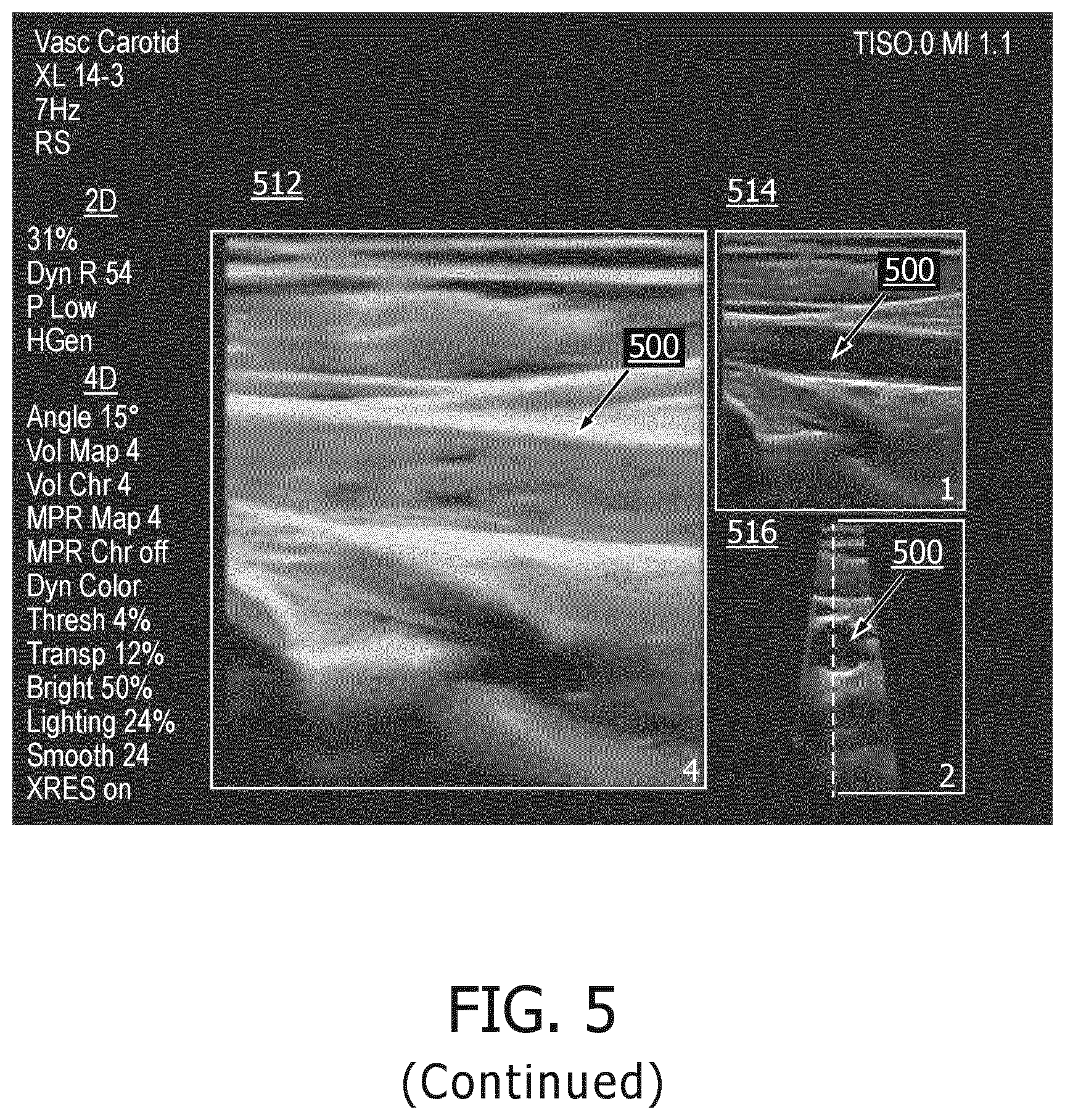Patent US12350104 Figure 6 – Systems and methods for controlling volume rate