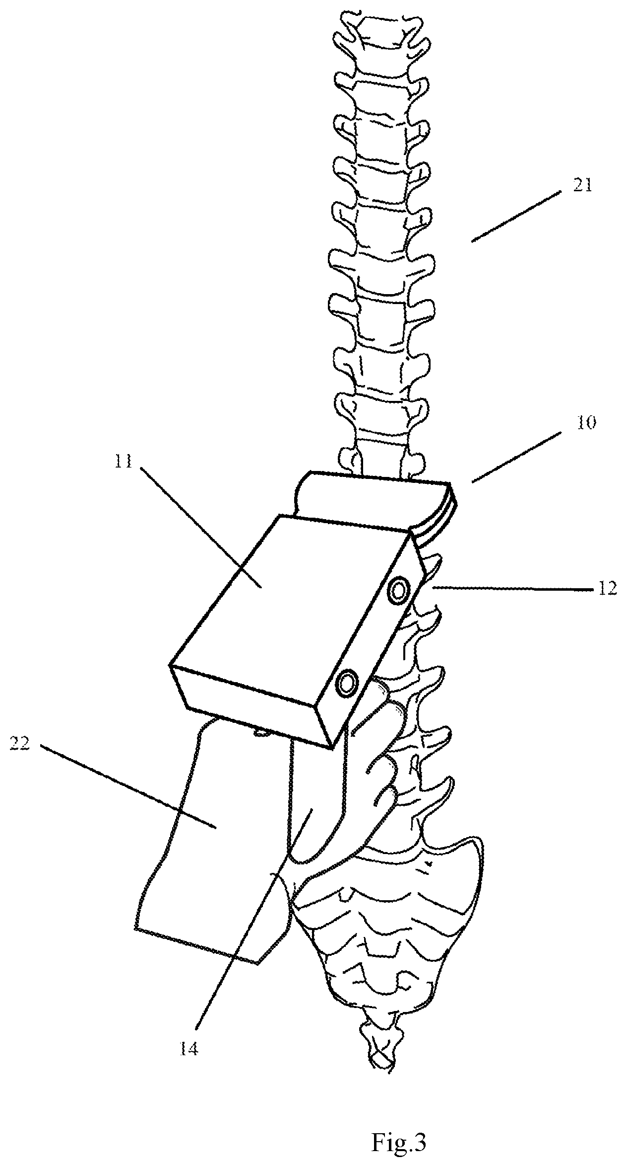 Patent US12350105 Figure 2 – Three-dimensional ultrasound imaging method and system based on three-dimensional tracking camera