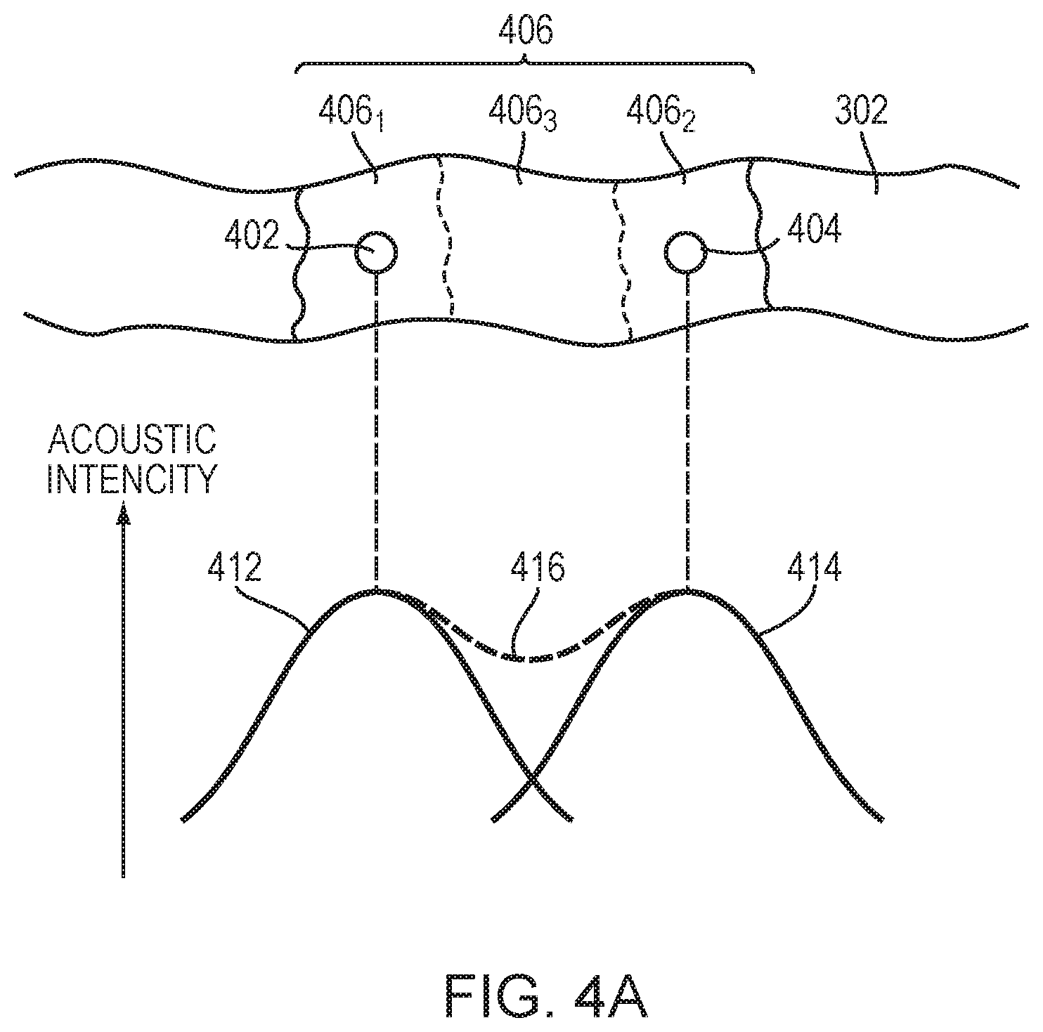 Patent US12350107 Figure 5 – Systems and methods for providing tissue information in an anatomic target region using acoustic reflectors
