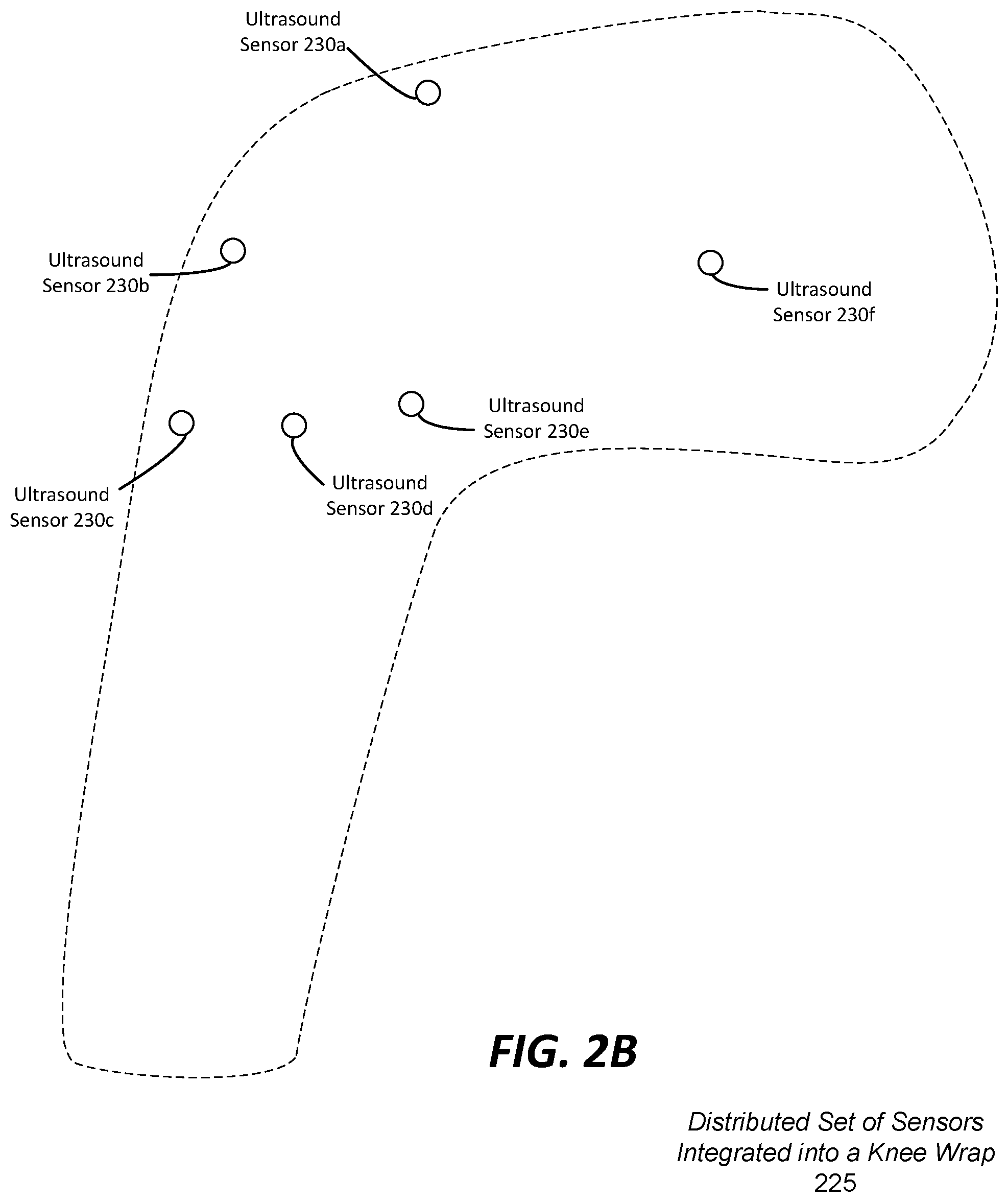 Patent US12350108 Figure 3 – Wearable imaging system for measuring bone displacement