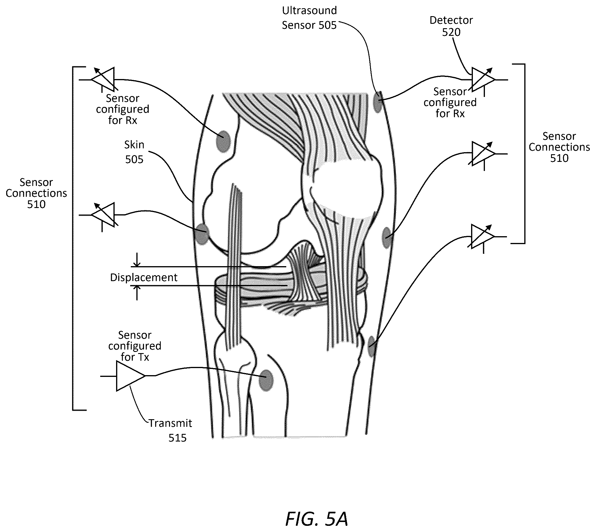 Patent US12350108 Figure 7 – Wearable imaging system for measuring bone displacement