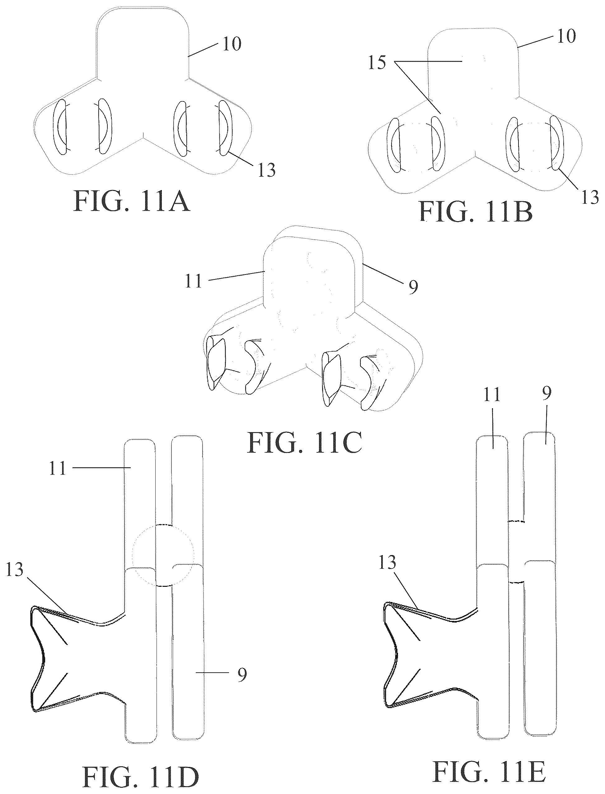 Patent US12350111 Figure 11 – Patient-matched apparatus for use in robotic assisted surgical procedures and methods for using the same