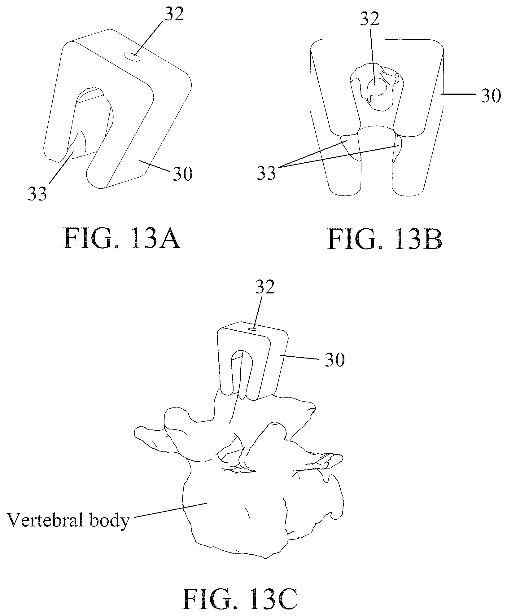 Patent US12350111 Figure 13 – Patient-matched apparatus for use in robotic assisted surgical procedures and methods for using the same