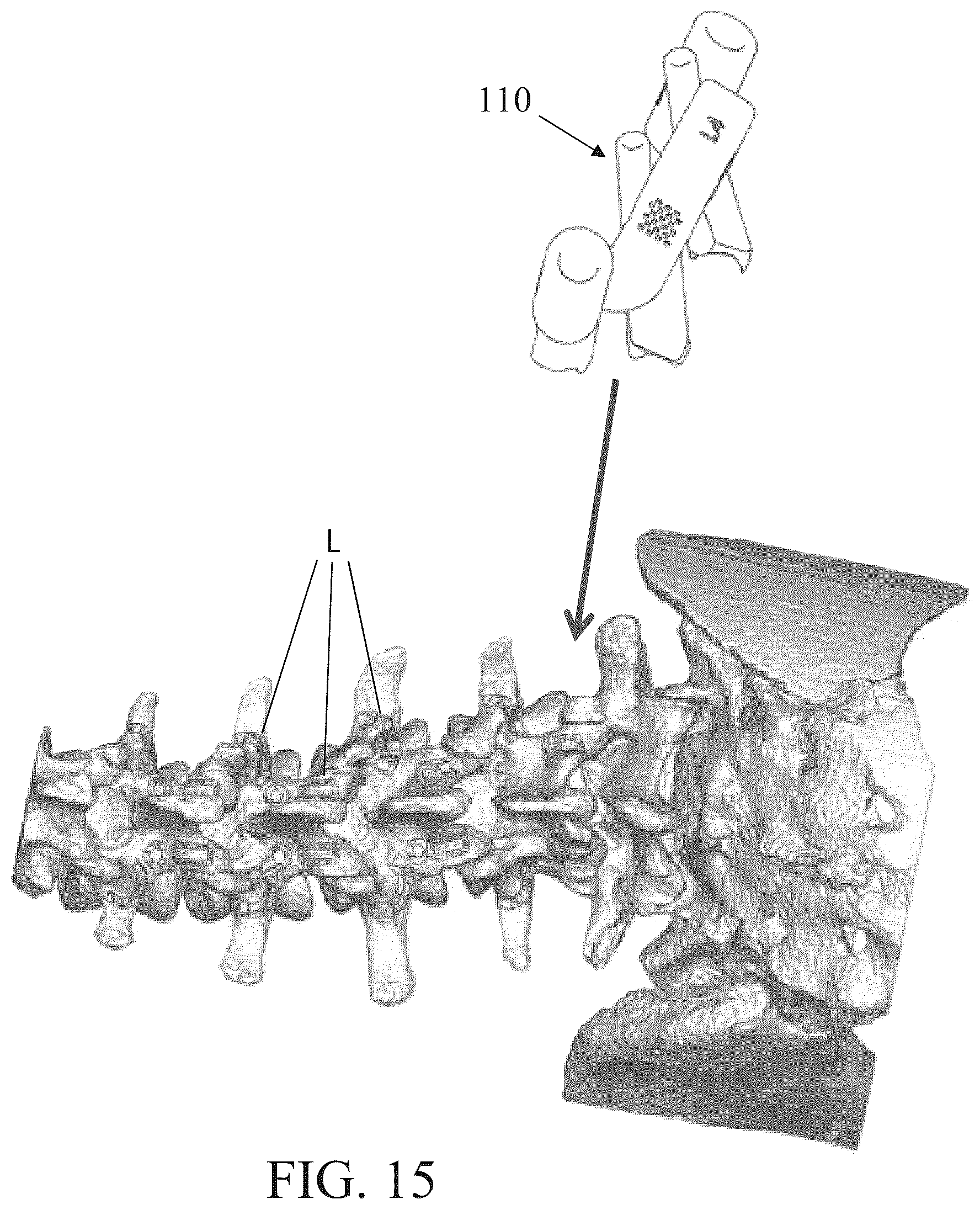 Patent US12350111 Figure 15 – Patient-matched apparatus for use in robotic assisted surgical procedures and methods for using the same