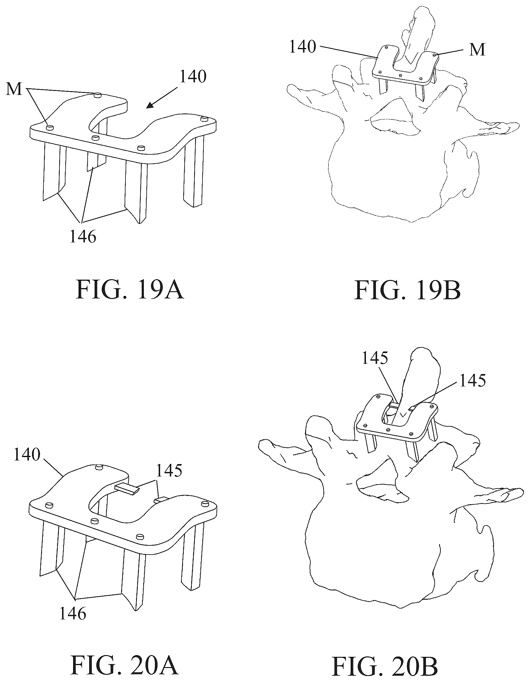 Patent US12350111 Figure 18 – Patient-matched apparatus for use in robotic assisted surgical procedures and methods for using the same