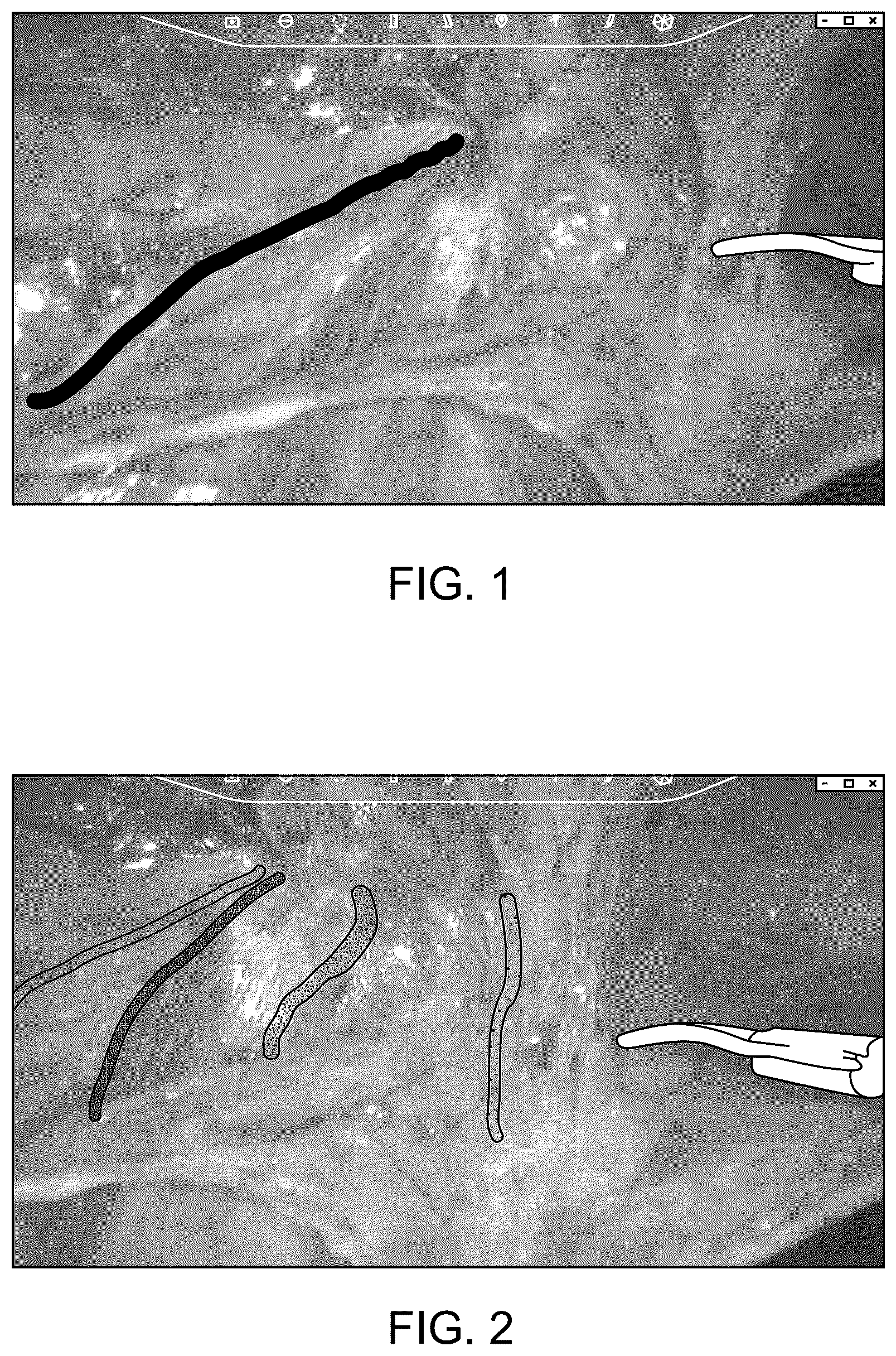Patent US12350112 Figure 1 – Creating surgical annotations using anatomy identification