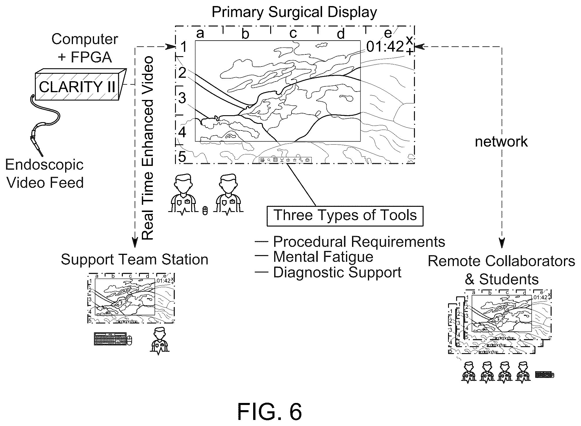 Patent US12350113 Figure 6 – System and method for enhanced data analysis with specialized video enabled software tools for medical environments