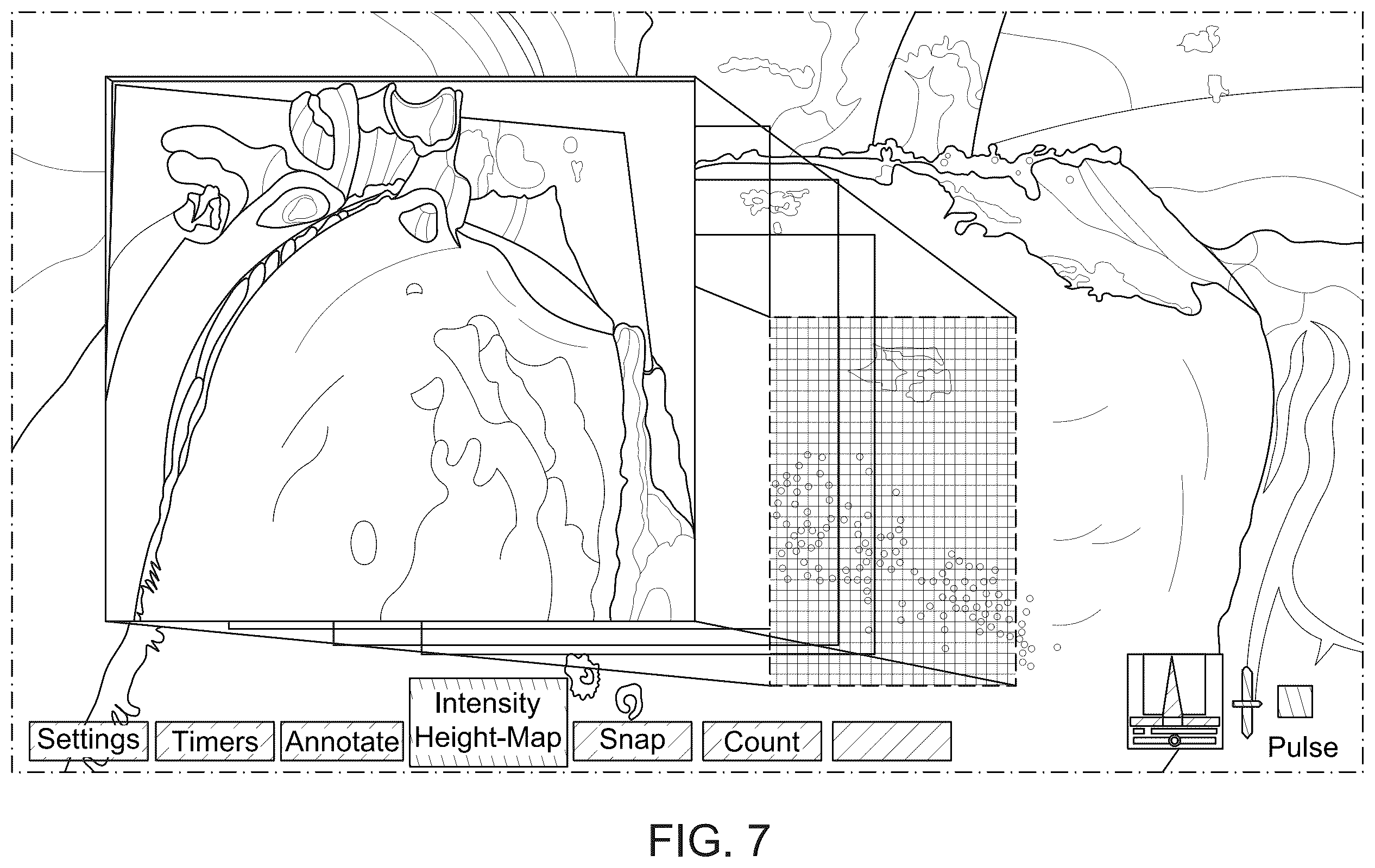 Patent US12350113 Figure 7 – System and method for enhanced data analysis with specialized video enabled software tools for medical environments