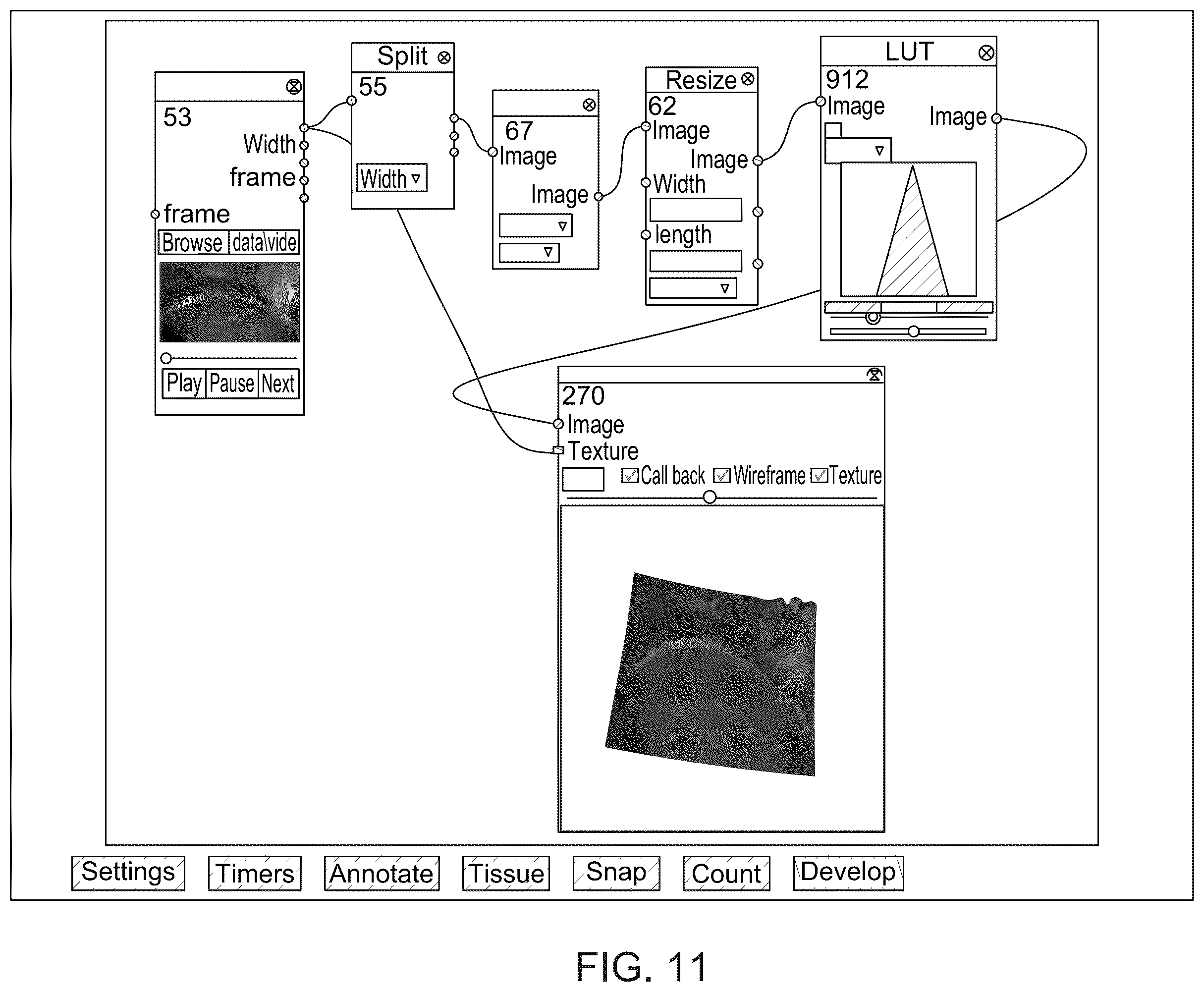 Patent US12350113 Figure 11 – System and method for enhanced data analysis with specialized video enabled software tools for medical environments