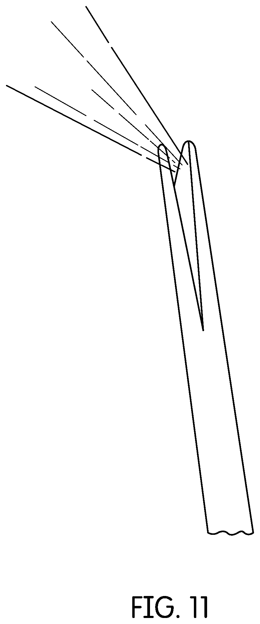 Patent US12350116 Figure 12 – Device for continuous irrigation with activation in endodontics application