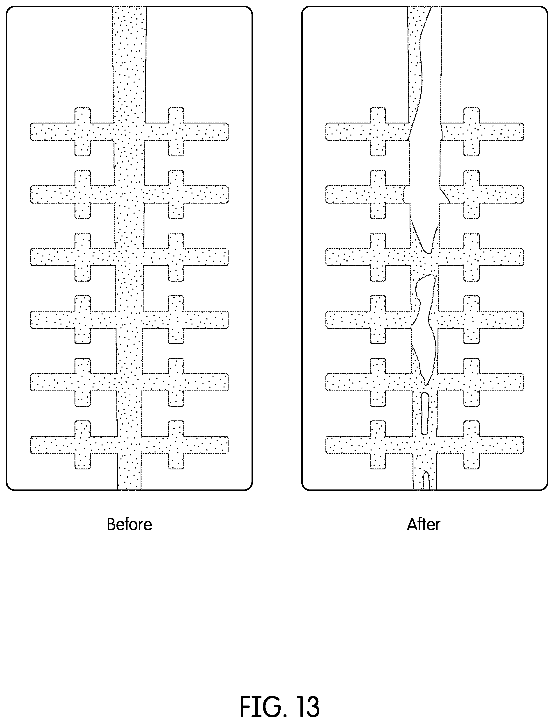 Patent US12350116 Figure 14 – Device for continuous irrigation with activation in endodontics application