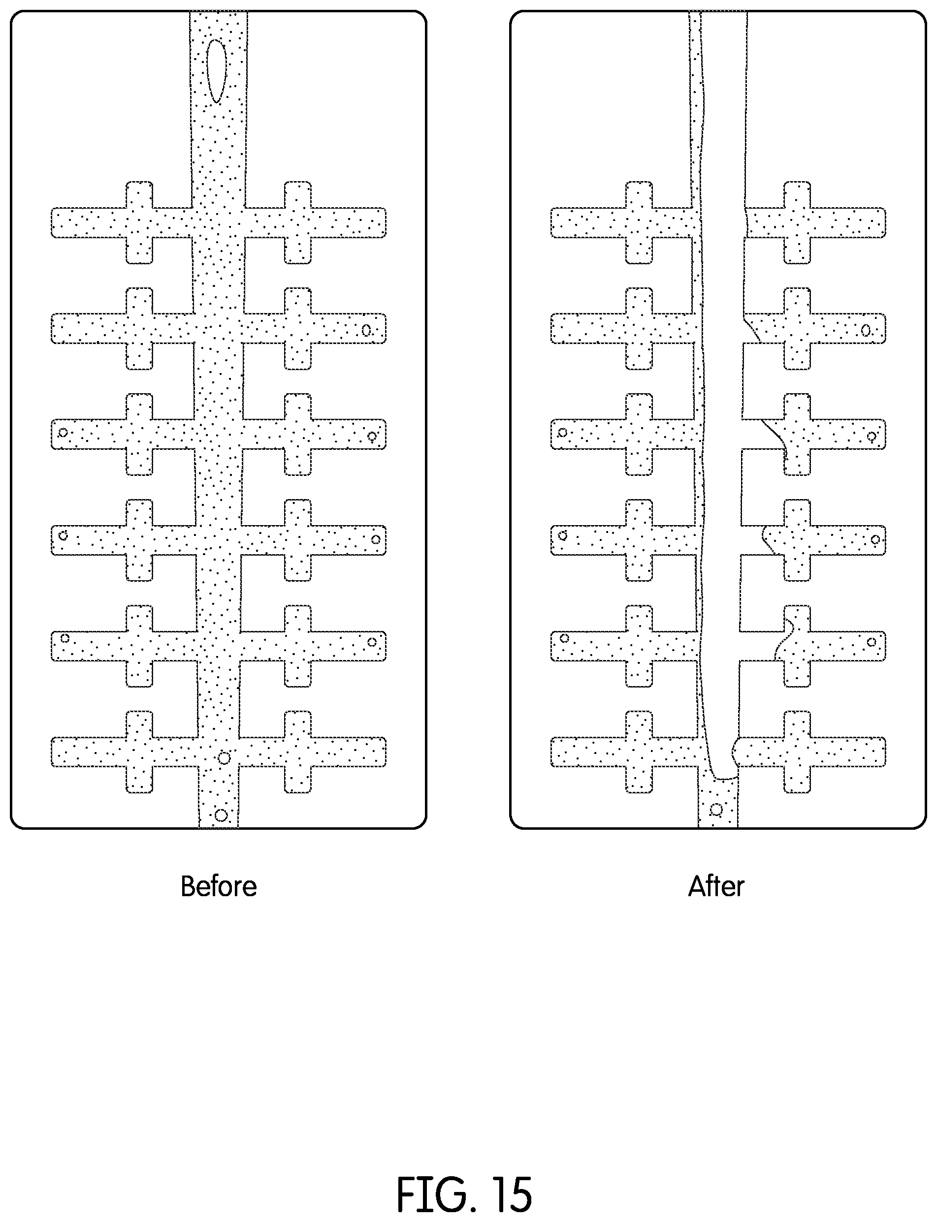 Patent US12350116 Figure 16 – Device for continuous irrigation with activation in endodontics application
