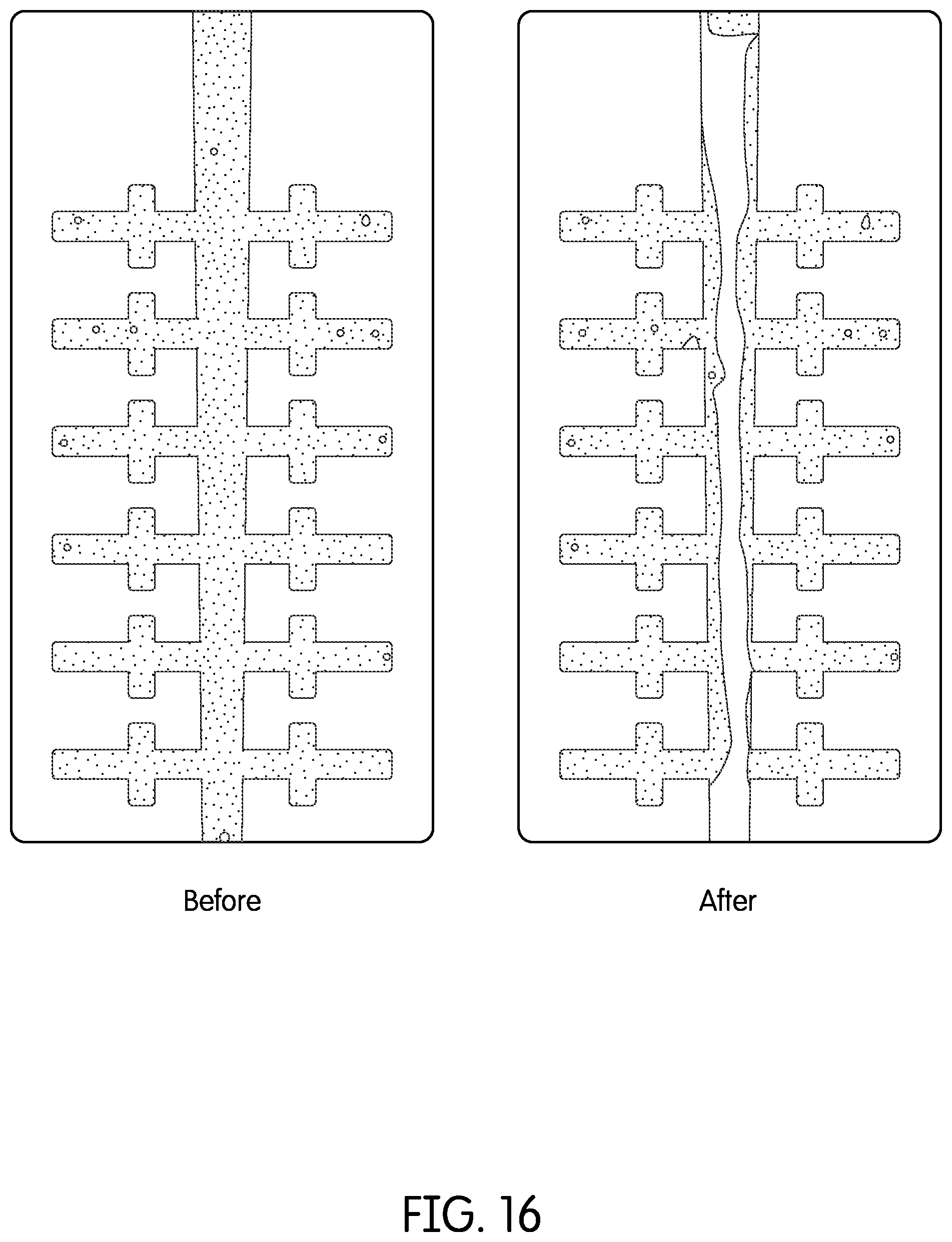 Patent US12350116 Figure 17 – Device for continuous irrigation with activation in endodontics application
