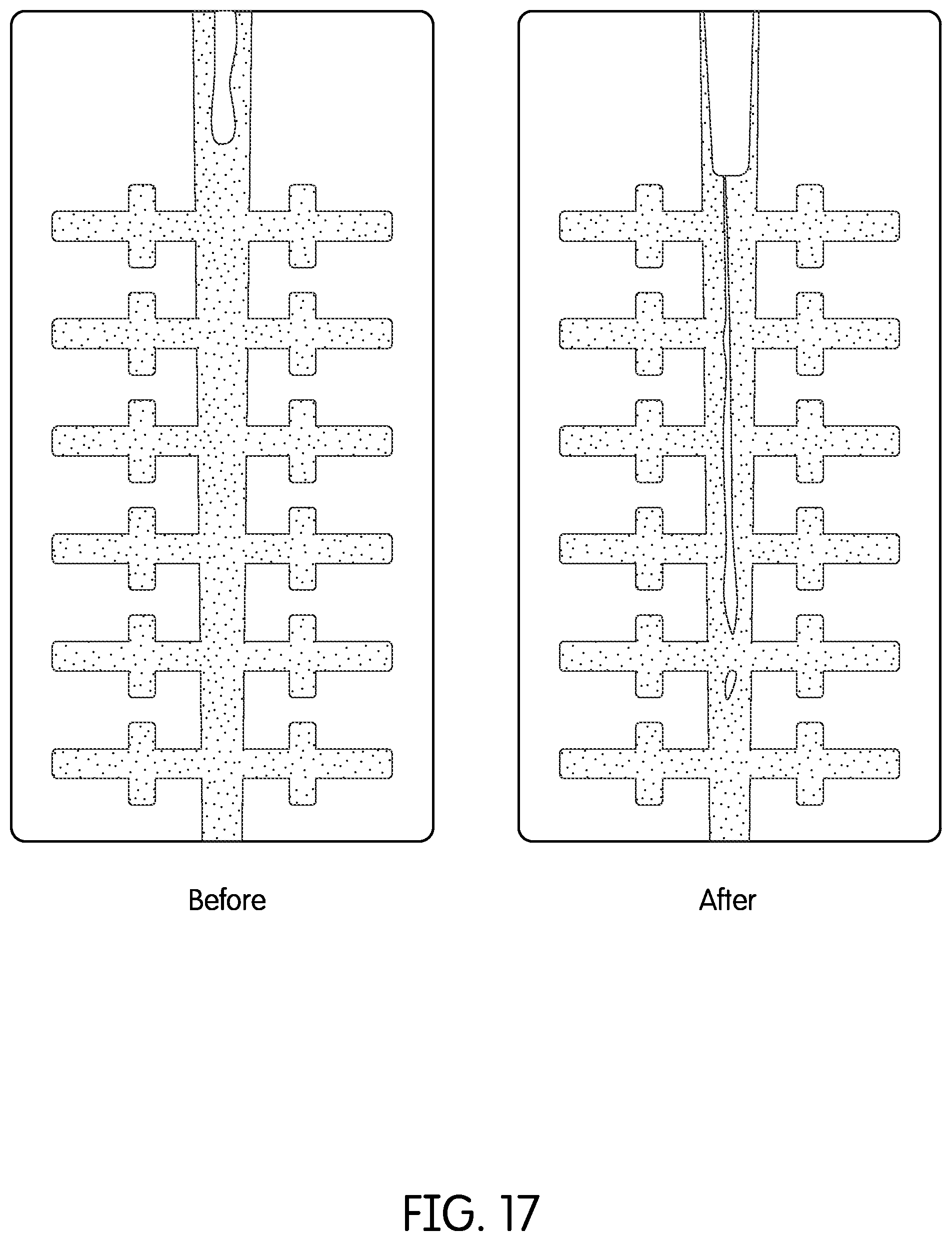 Patent US12350116 Figure 18 – Device for continuous irrigation with activation in endodontics application