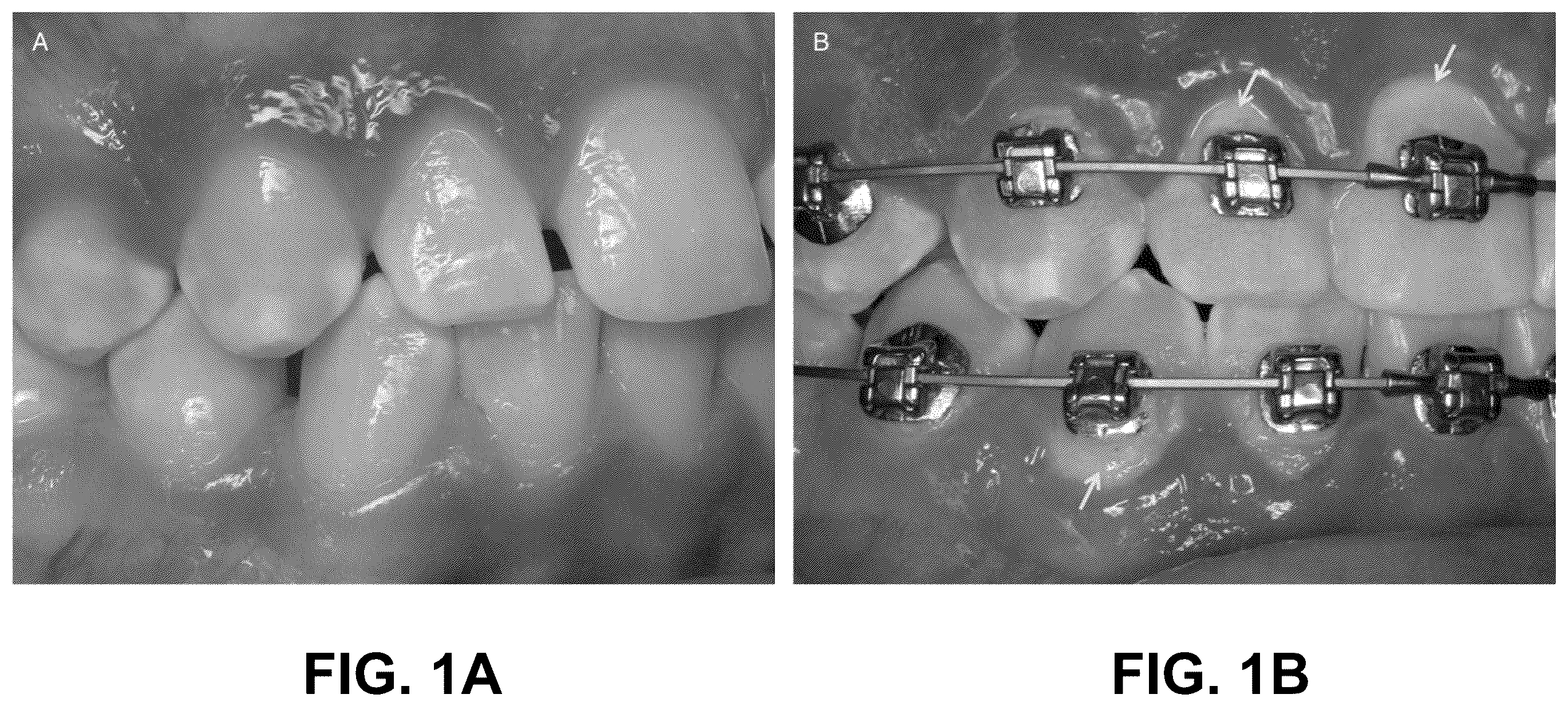 Patent US12350117 Figure 1 – Oral hygiene devices configured for use with orthodontics
