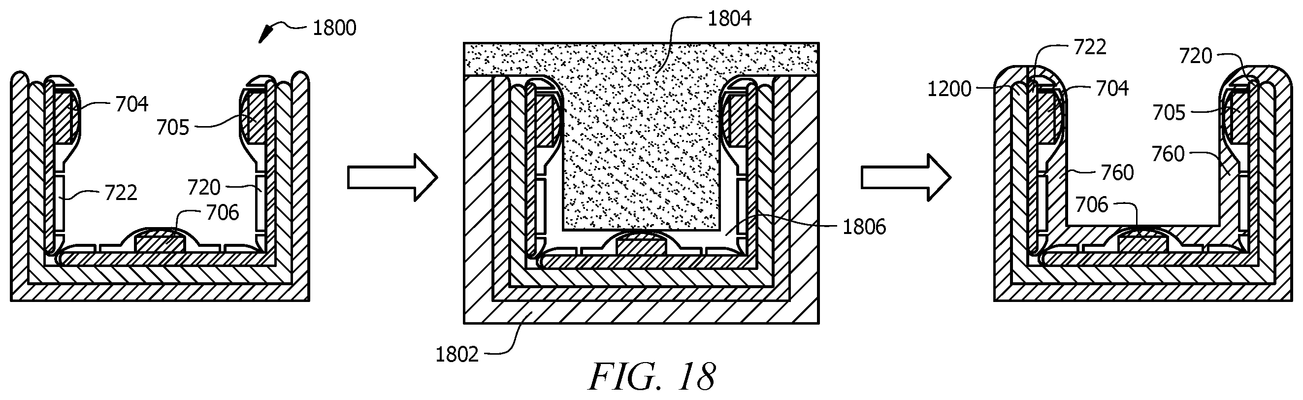 Patent US12350119 Figure 12 – Intra-oral appliance for delivering red, near-infrared and blue light for oral tissue healing